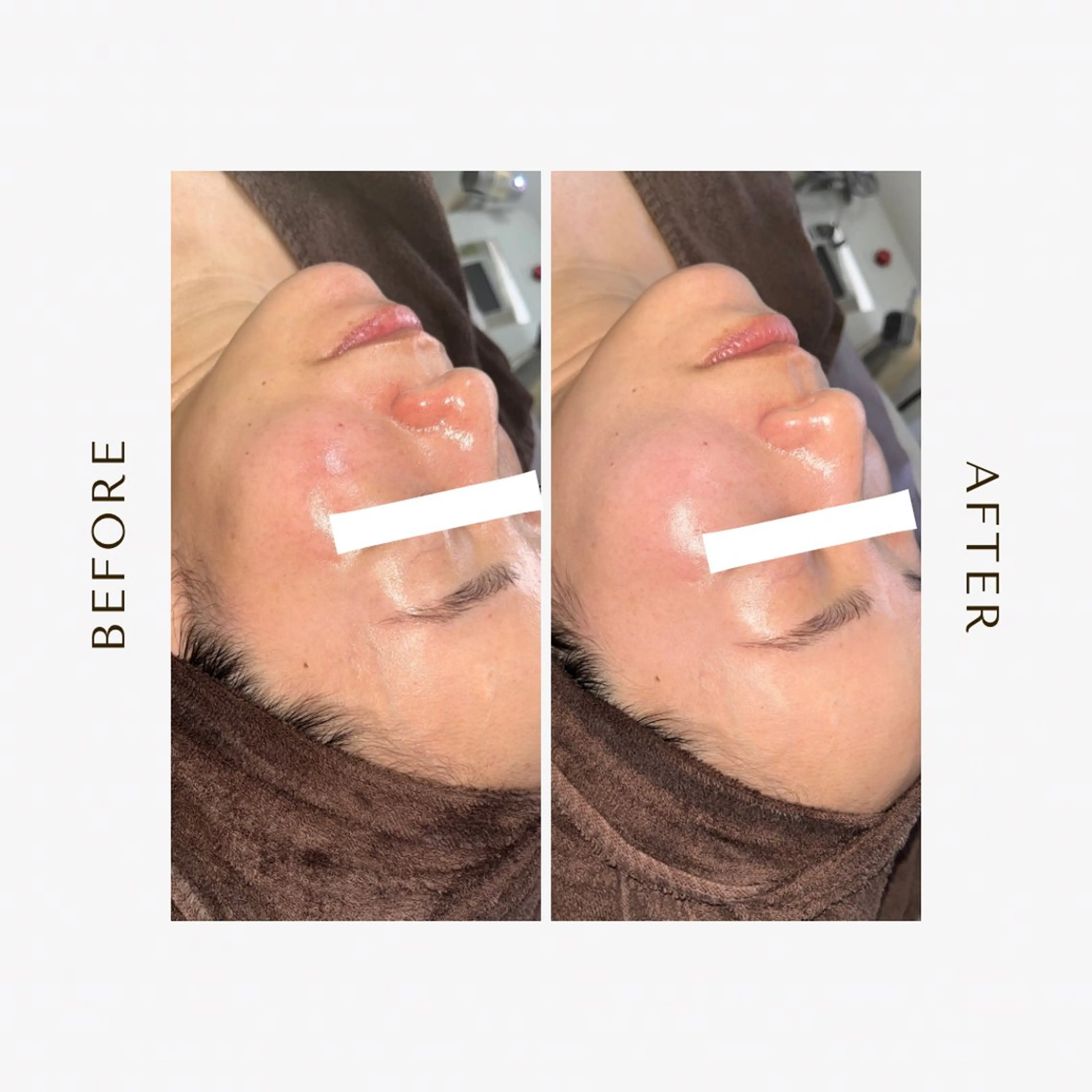 エステ 1st｜フェイシャル エステ専門店のエステ・リラクイメージ