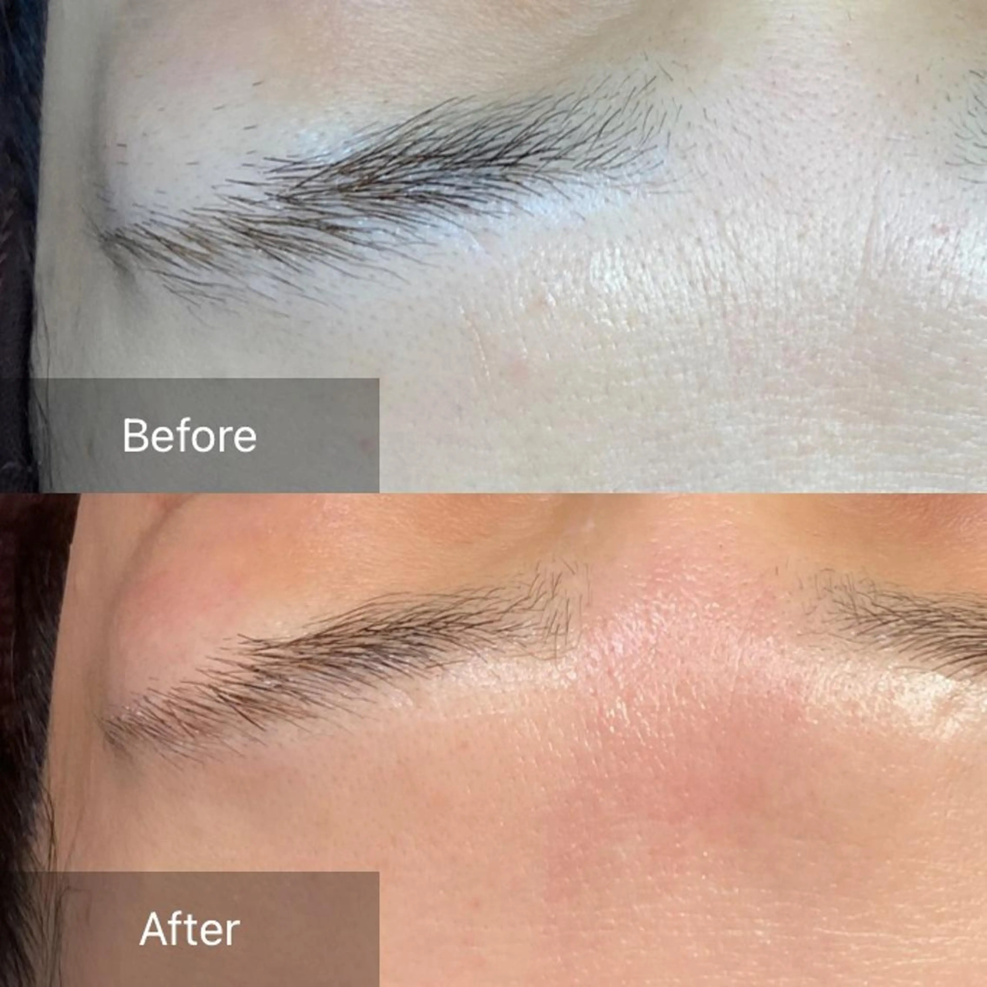 脱毛 産毛専門店 Bittoのエステ・リラクイメージ