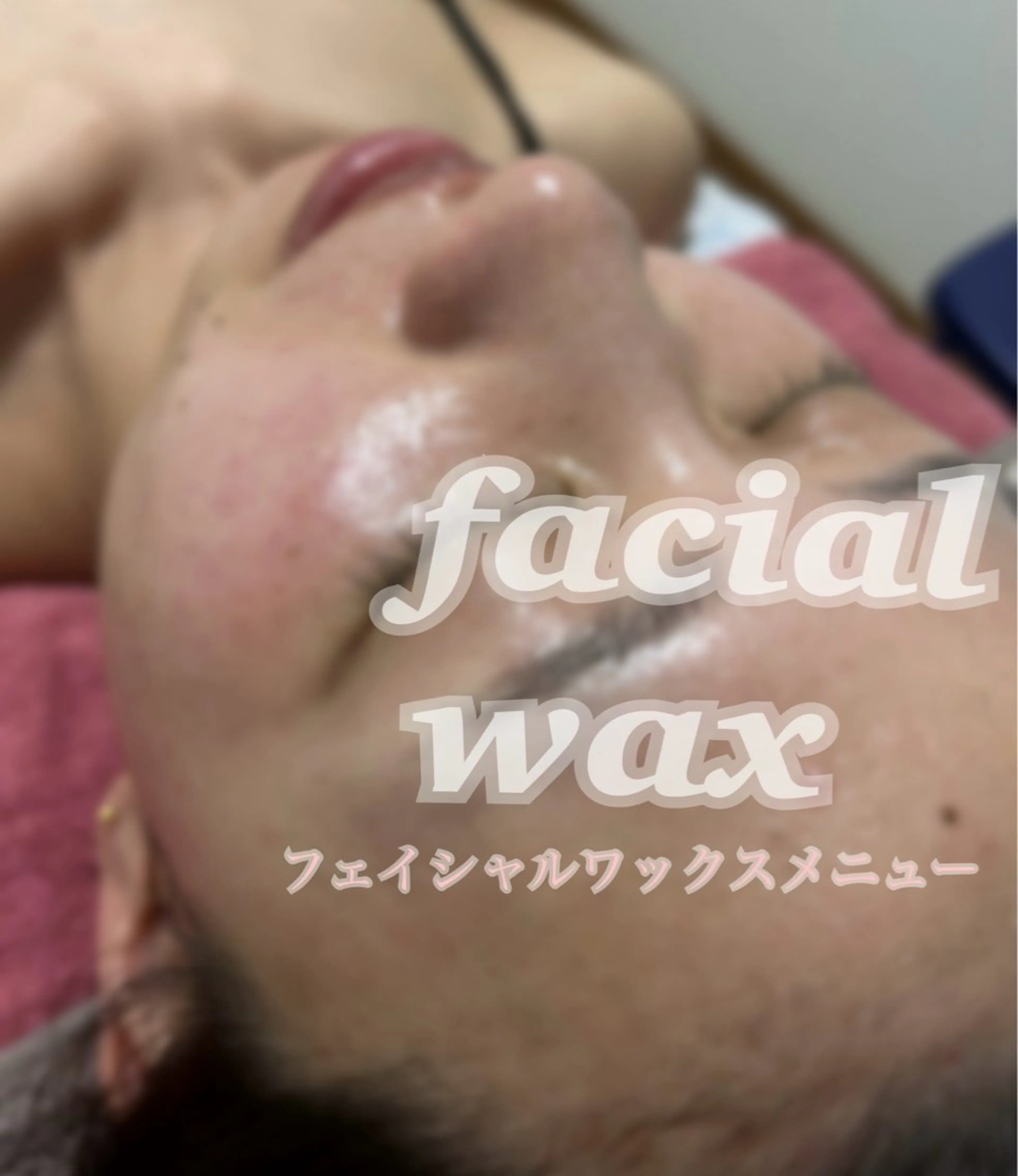 フェイシャルワックス(クレンジング→洗顔→保湿→WAX脱毛→保湿→鎮静パック→お仕上げ)の写真
