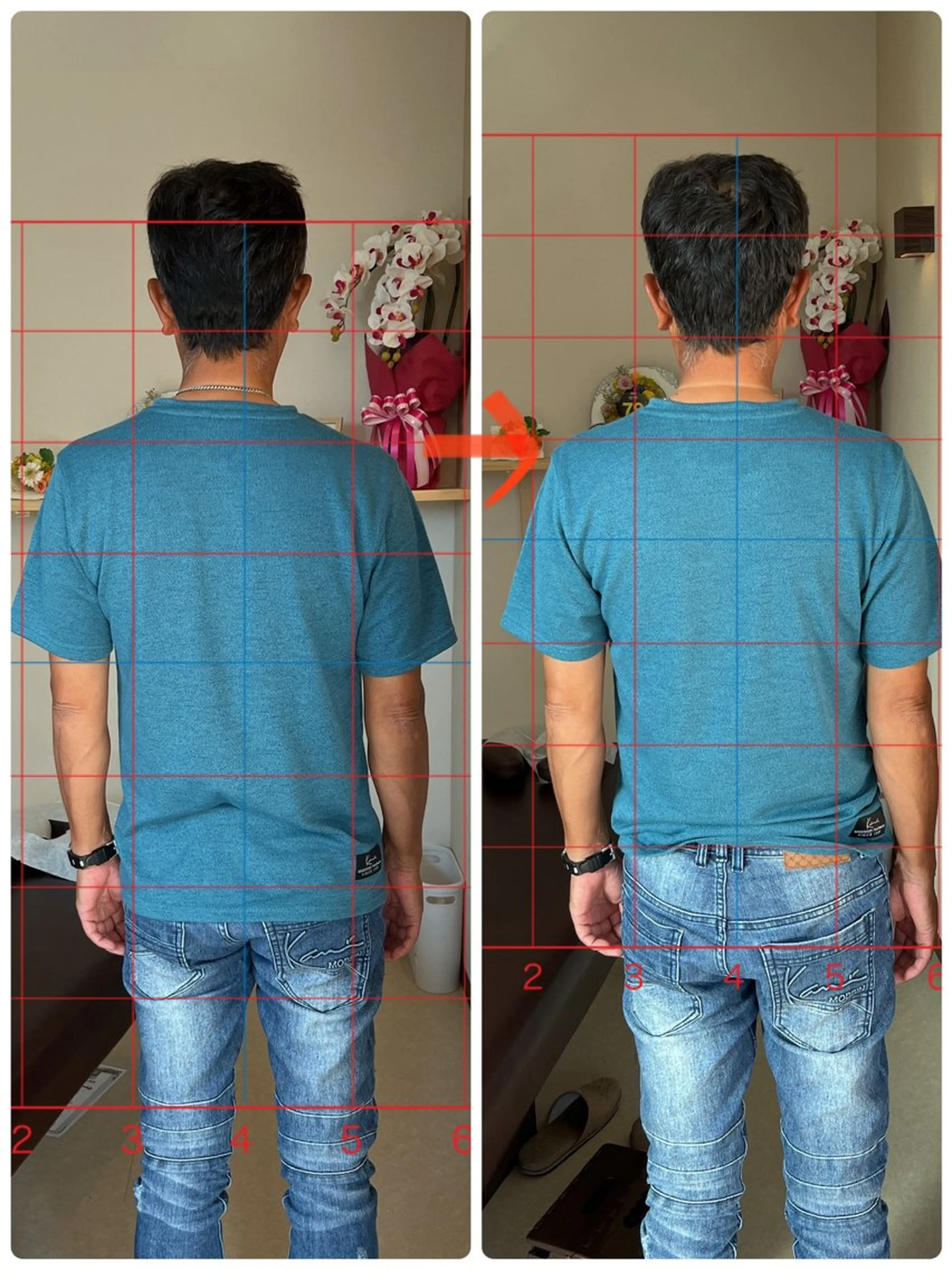 猫背矯正の写真