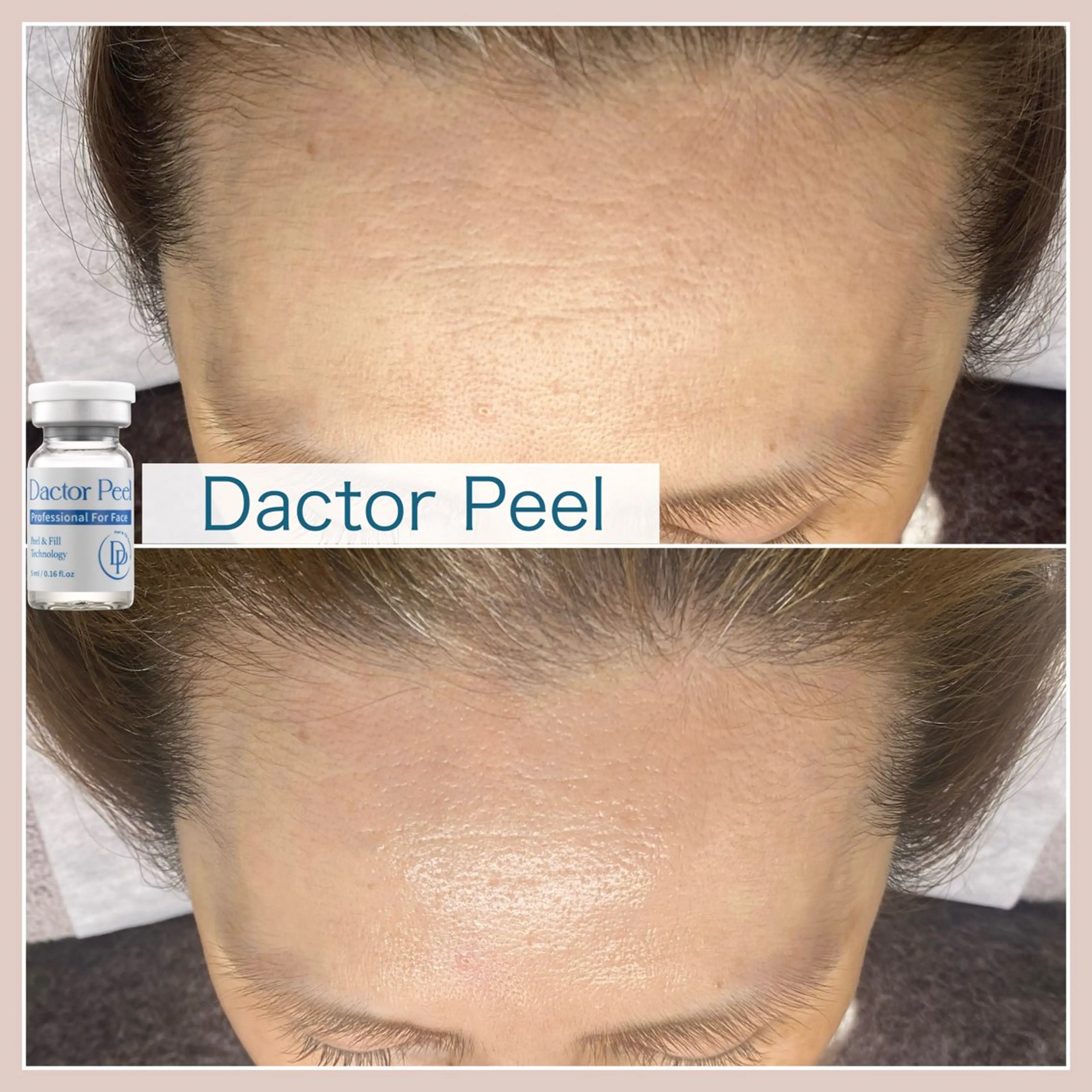 mone (モーネ)のエステ・リラクイメージ