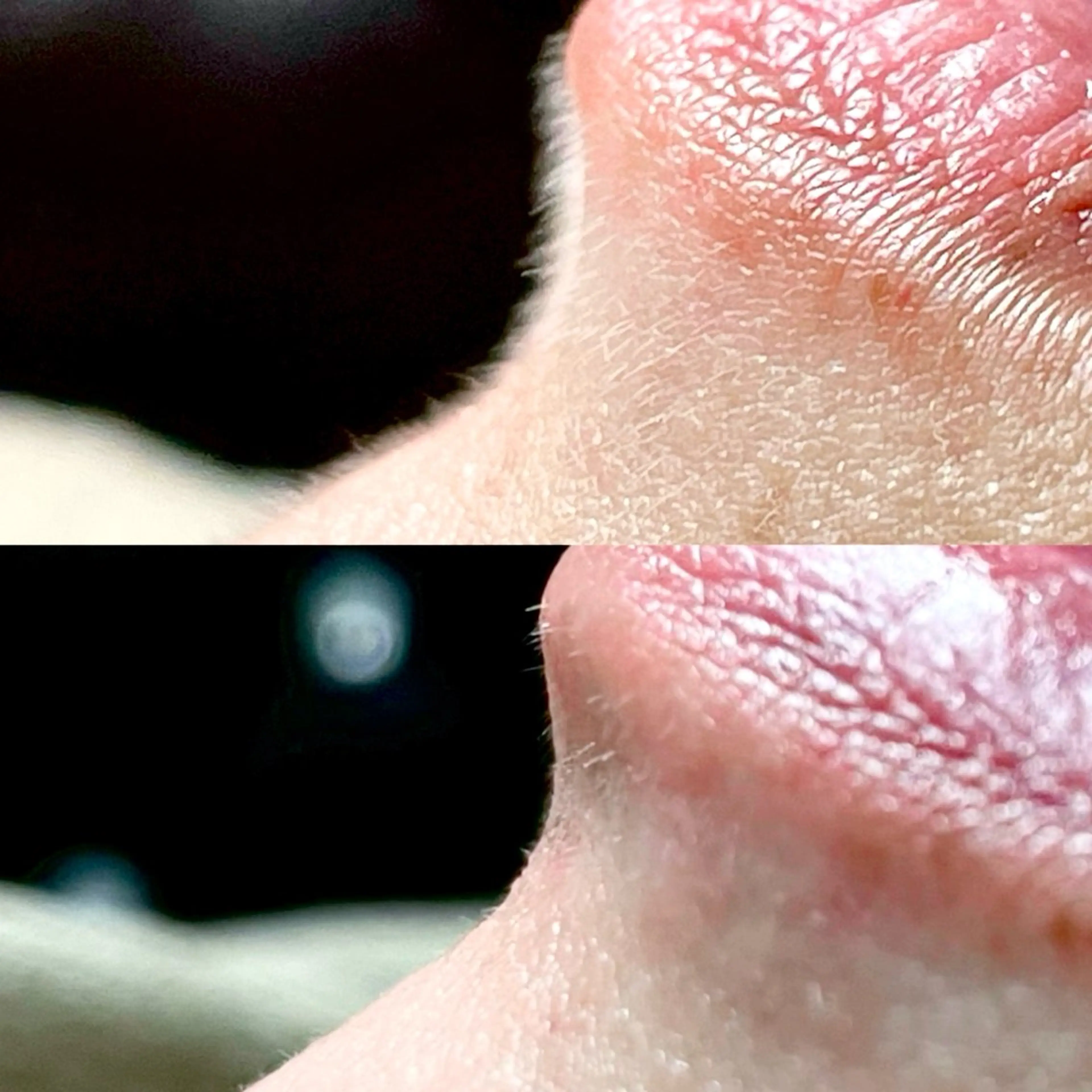 フェイシャルワックスの写真