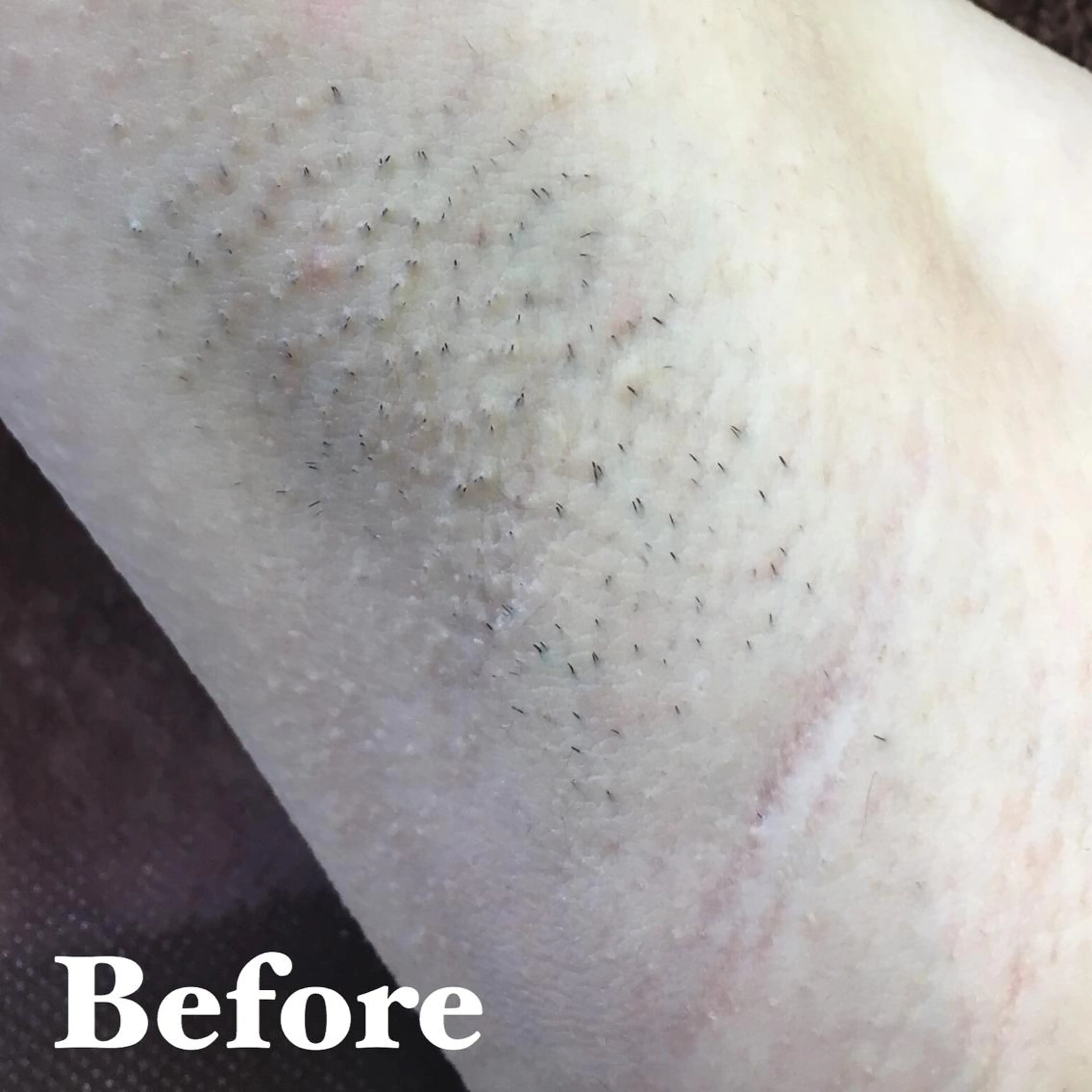 MIMI 吉祥寺本店のエステ・リラクイメージ