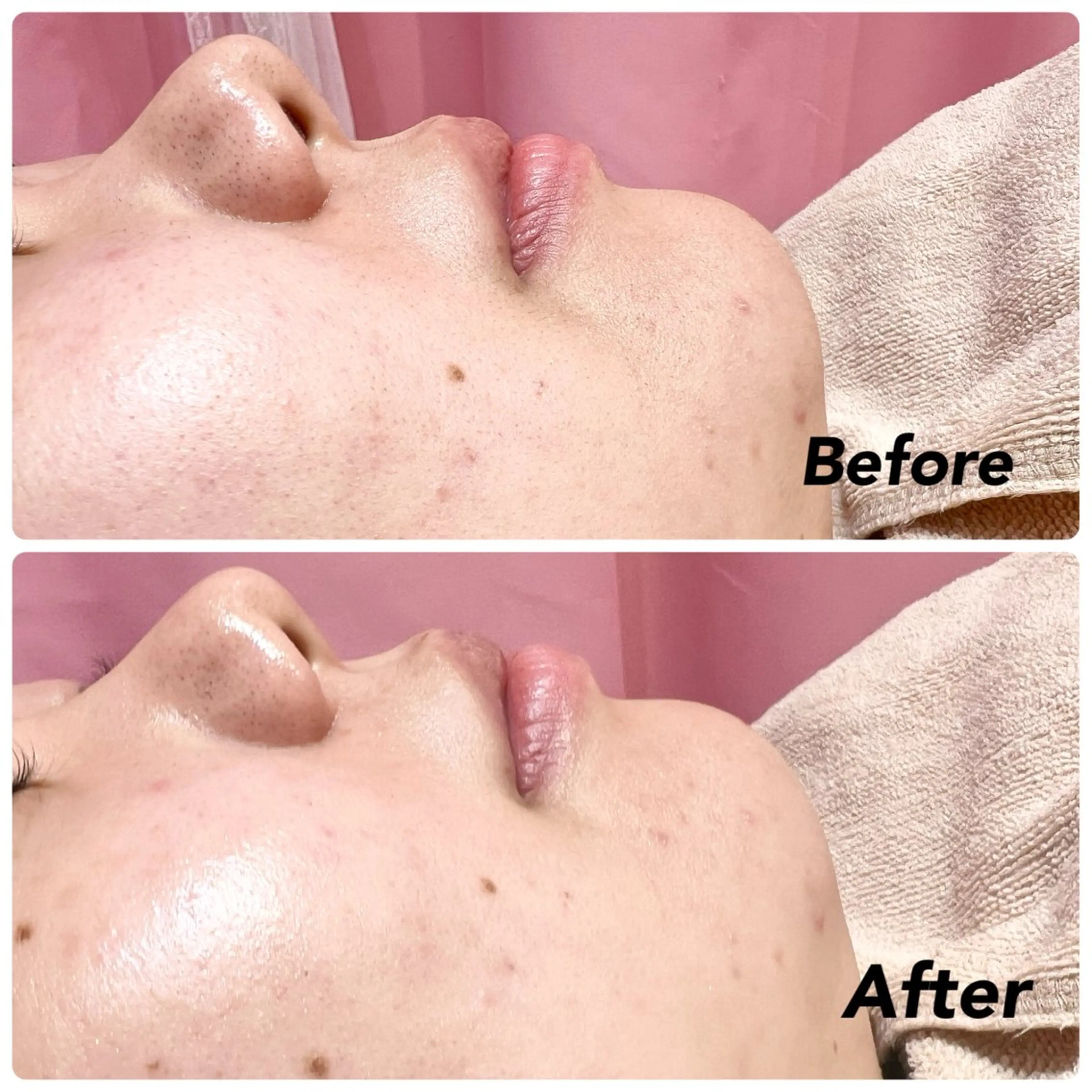 🩵新宿シェービング 店長🩵清水のその他イメージ