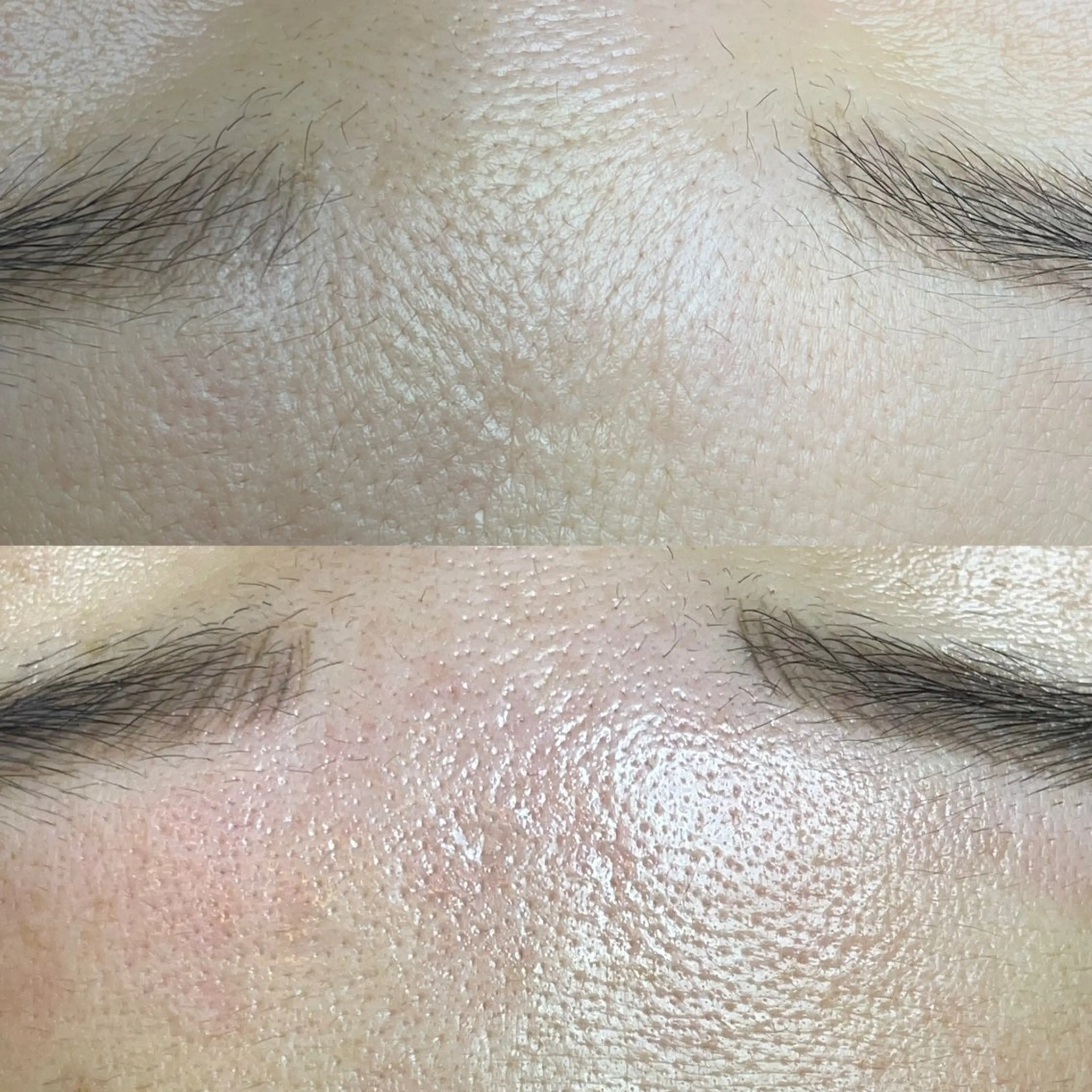 エステ リラク 夕希 毛穴と脱毛特化サロンのエステ・リラクイメージ