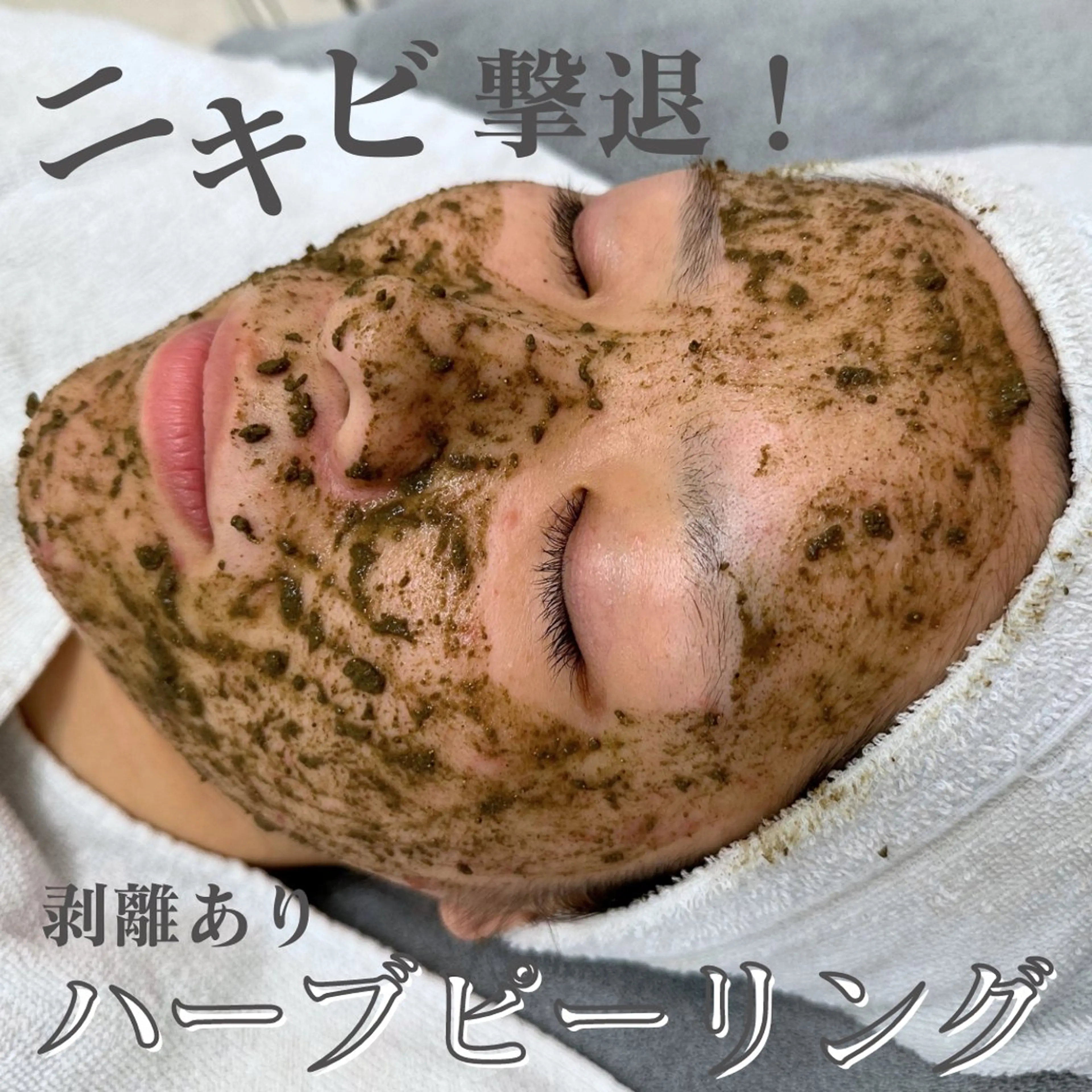 エステ BestBelleꕤ 大阪福島/肌質改善のエステ・リラクイメージ