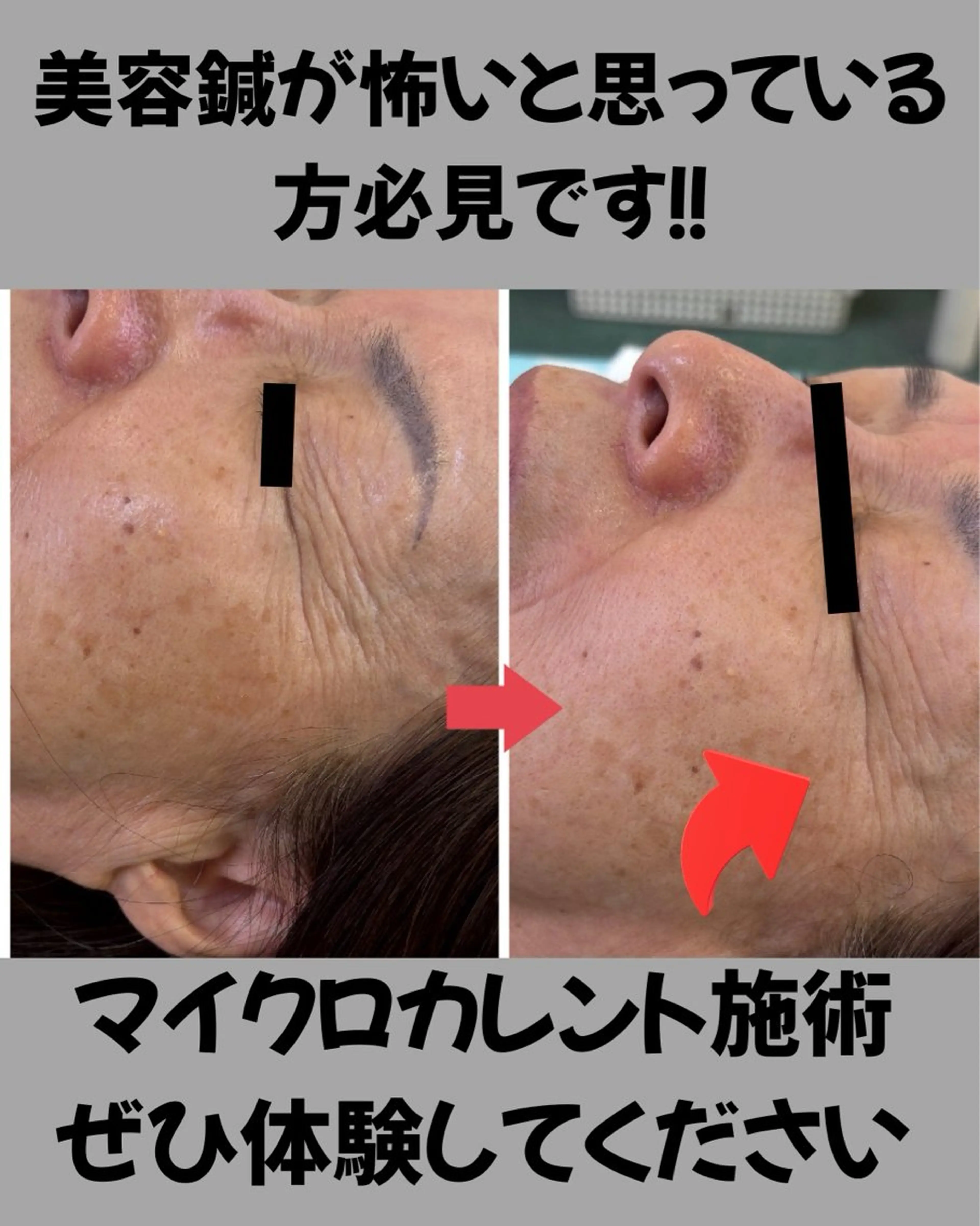 あおぞら 鍼灸整骨院のエステ・リラクイメージ