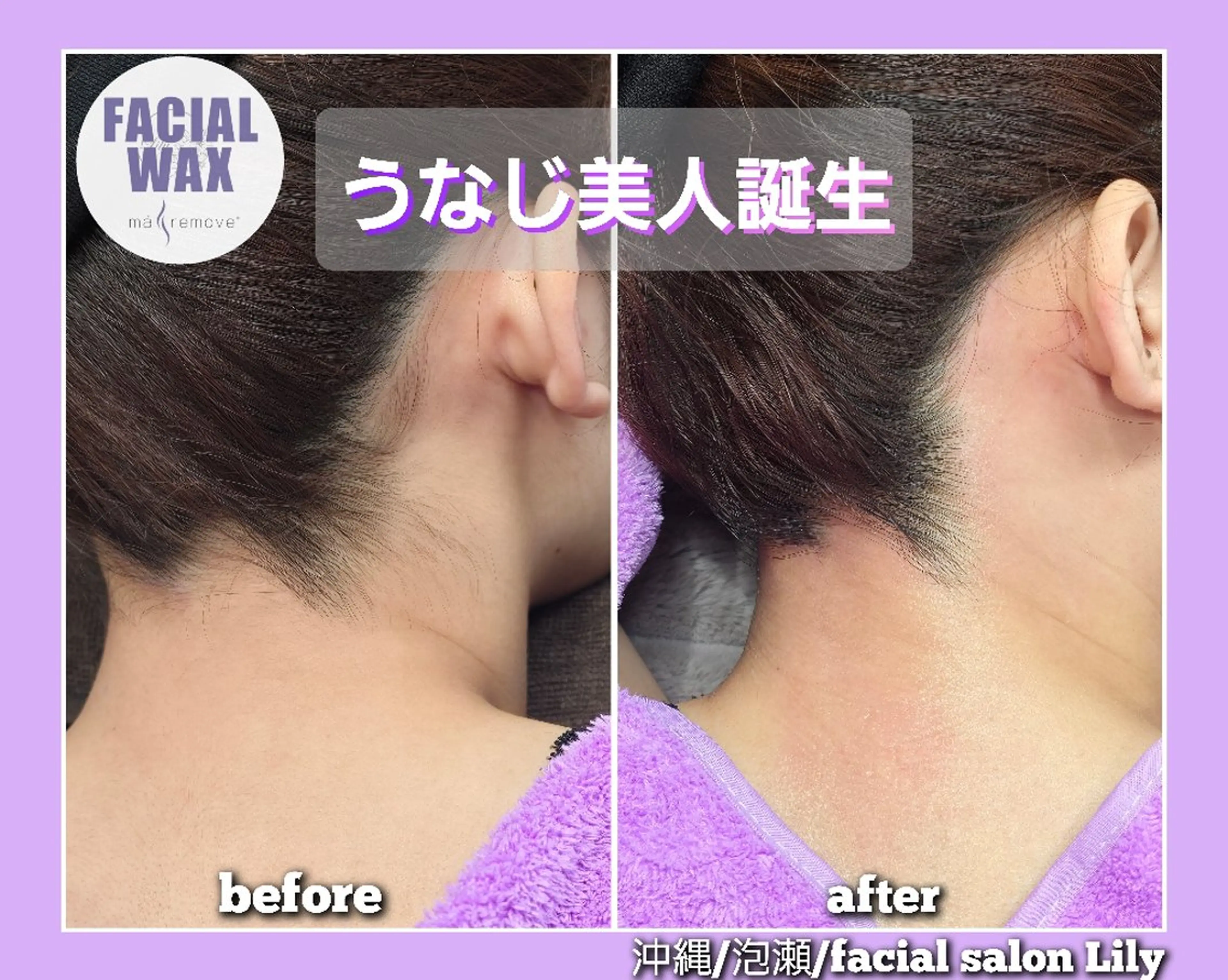 脱毛 salon Lilyのエステ・リラクイメージ