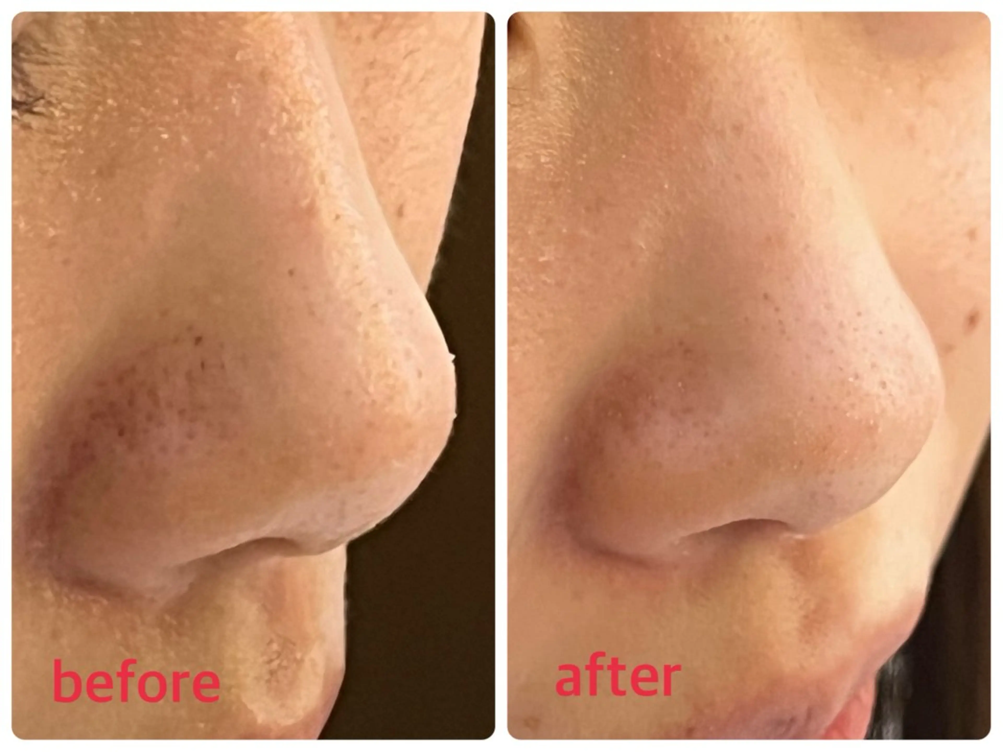 Natura ナトァーラのヘアスタイル