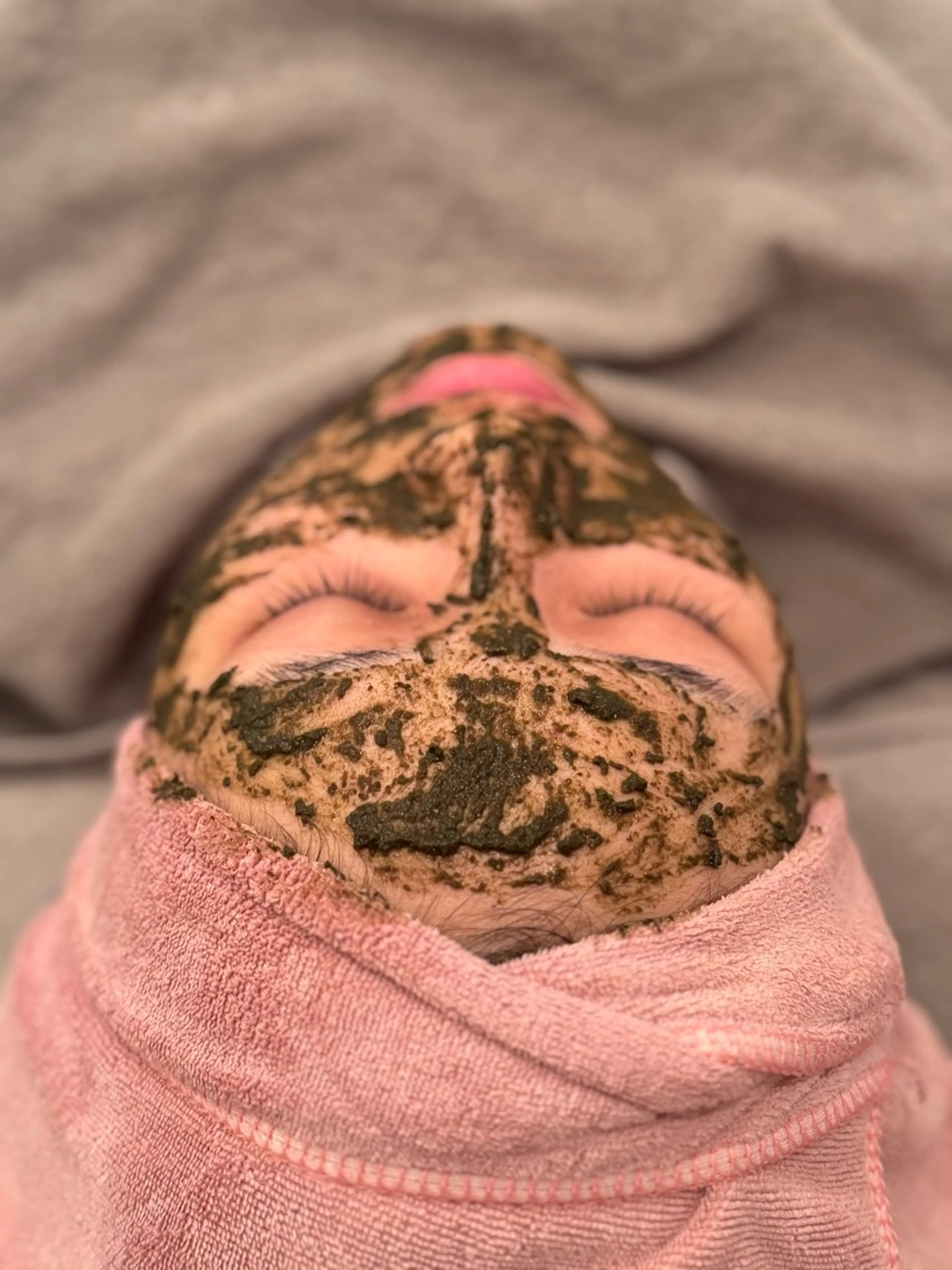 《ハーブピーリング剥離あり》クレンジング+泡パック+毛穴洗浄＋ハーブピーリング(剥離あり)+パック+おしあげの写真