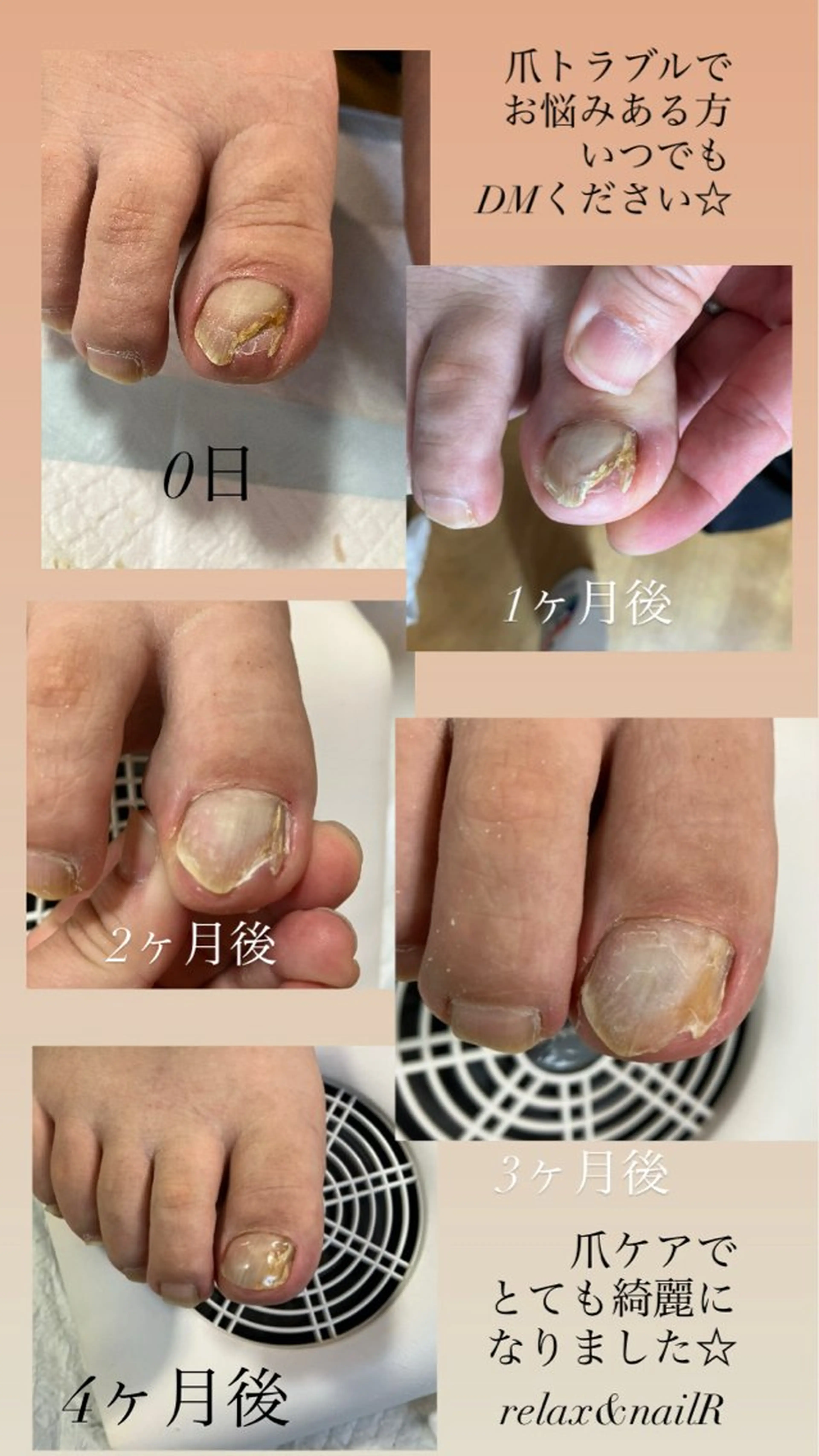 ネイル フットネイル relax&nail Rのエステ・リラクイメージ