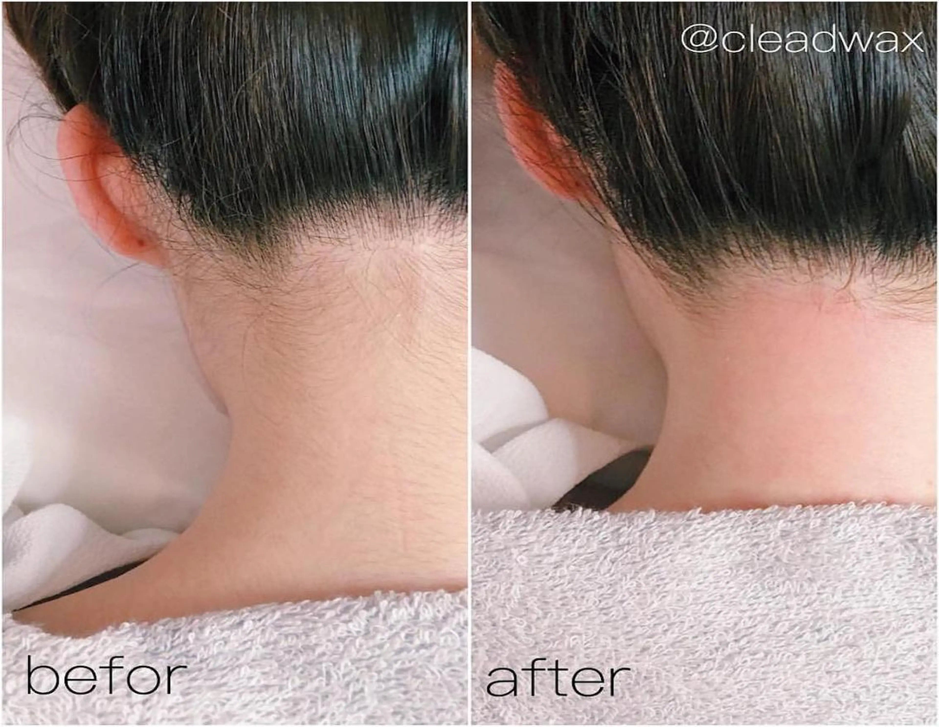 CLEAD 赤坂見附店のエステ・リラクイメージ