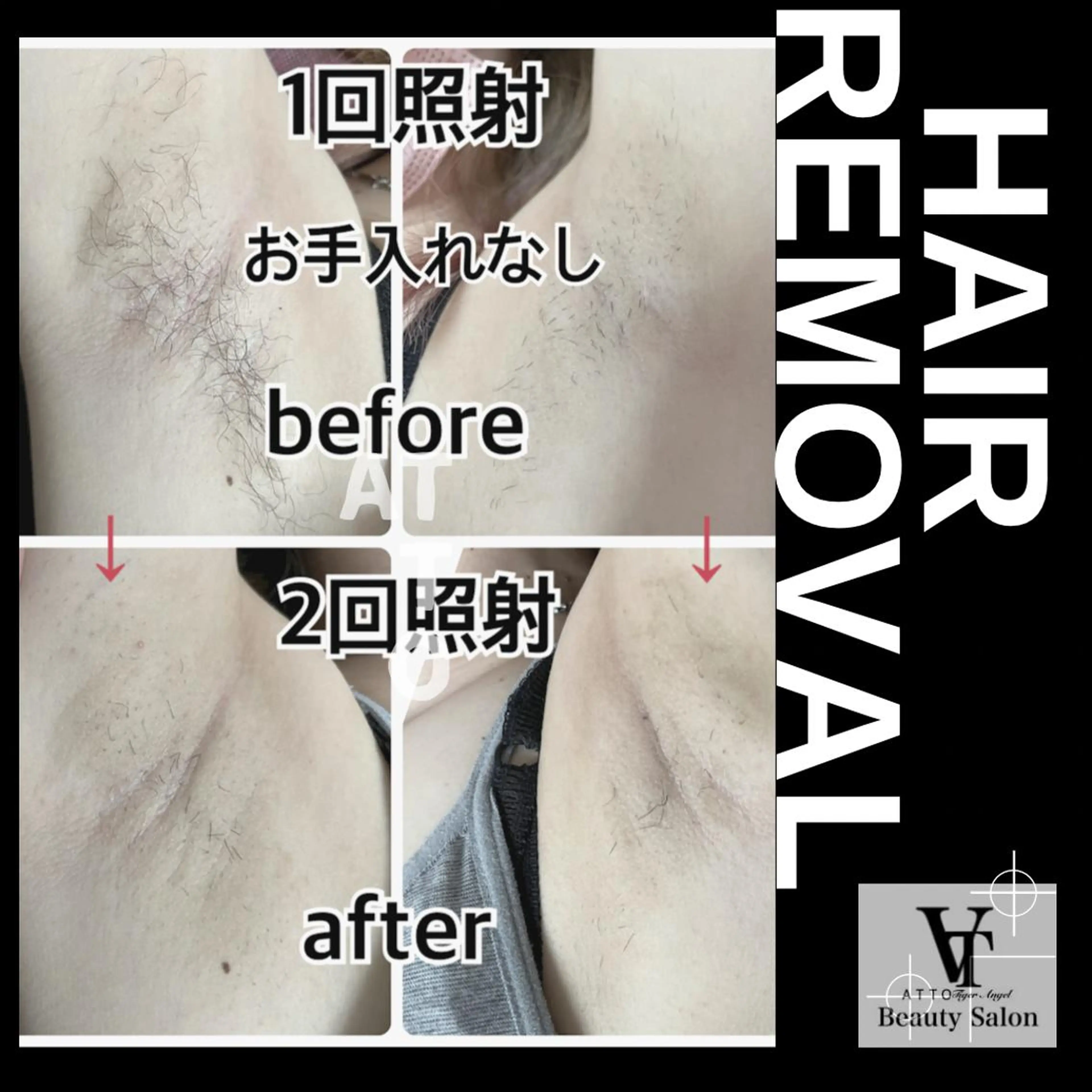 メンズ ネイル 脱毛 ATTO SHIORIのエステ・リラクイメージ