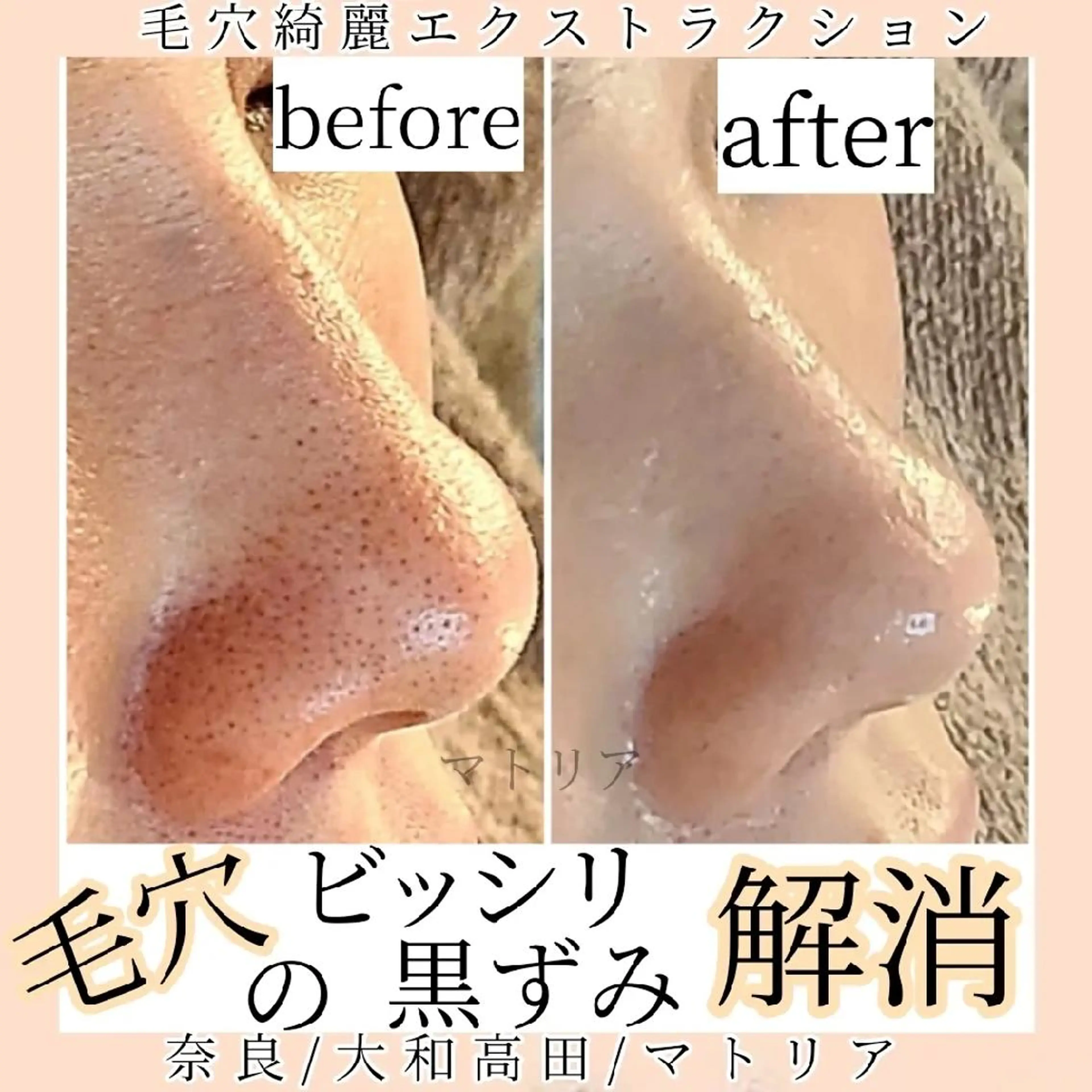 小顔 美肌専門 Matoriaのエステ・リラクイメージ