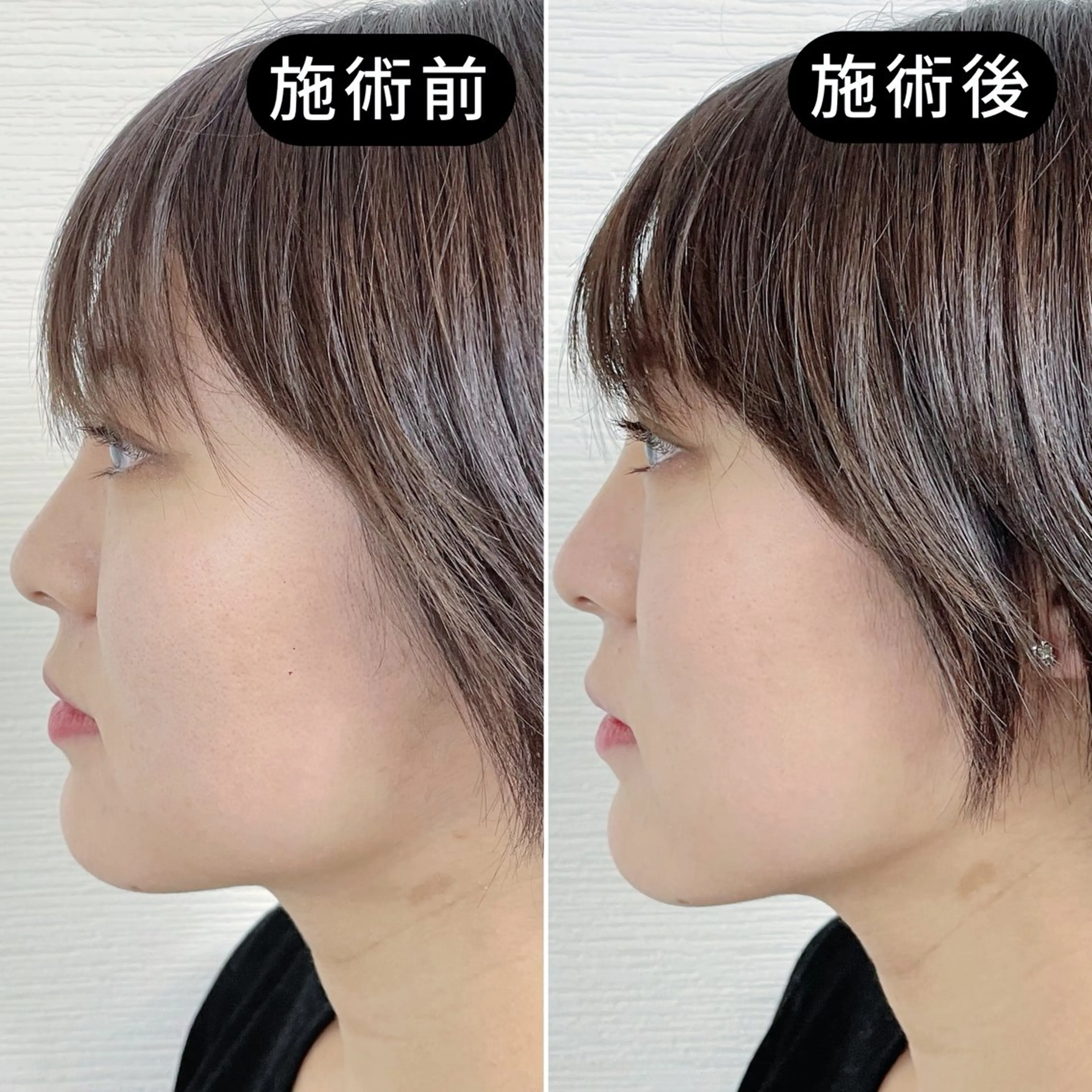 【迷ったらコレ】むくみ・左右差・肌悩みも当日相談OKの写真