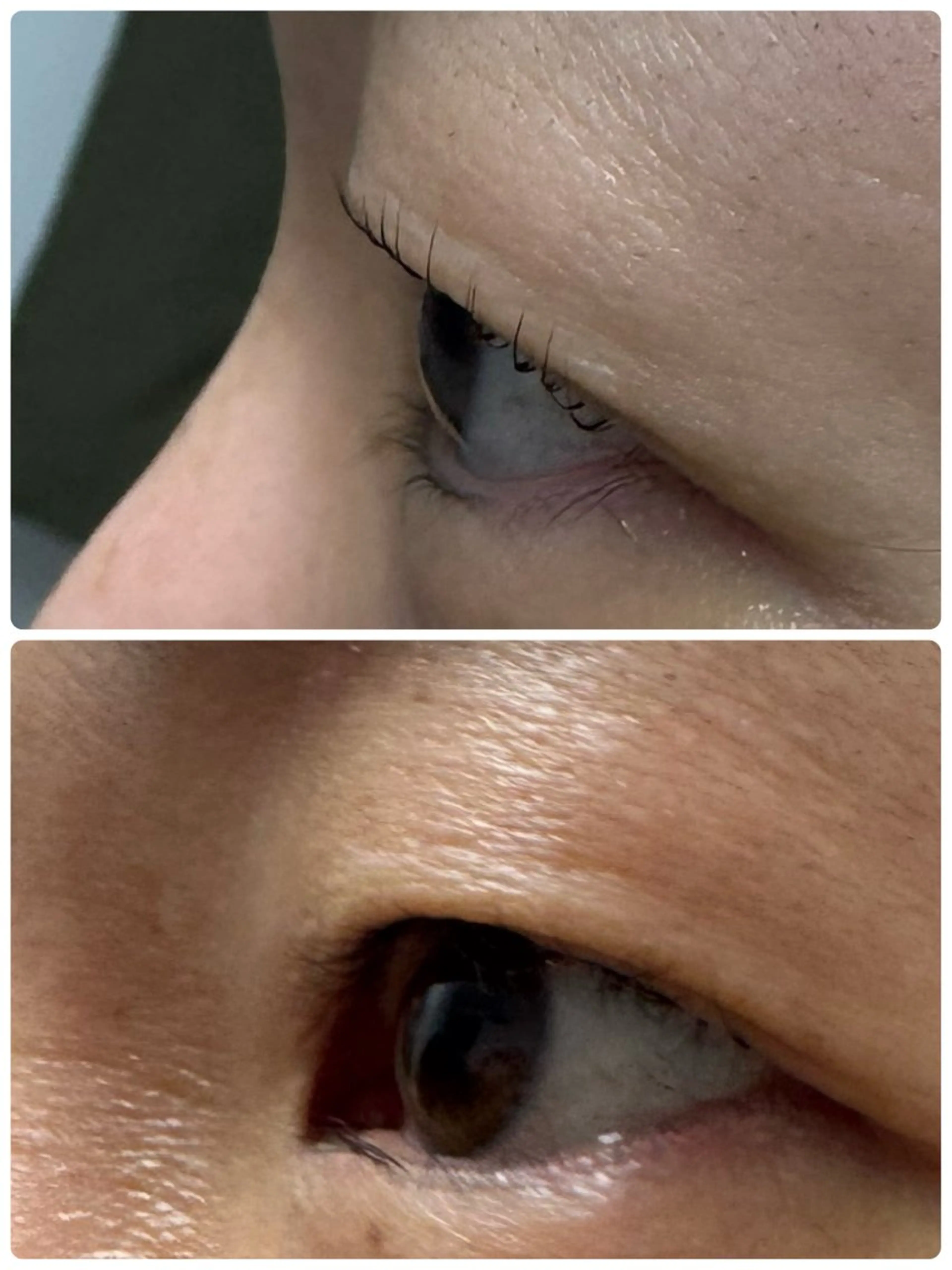 マツエク・マツパ 一重×まつ毛パーマ マツパ◎LED マツエク,モチ◎のマツエク・マツパデザイン