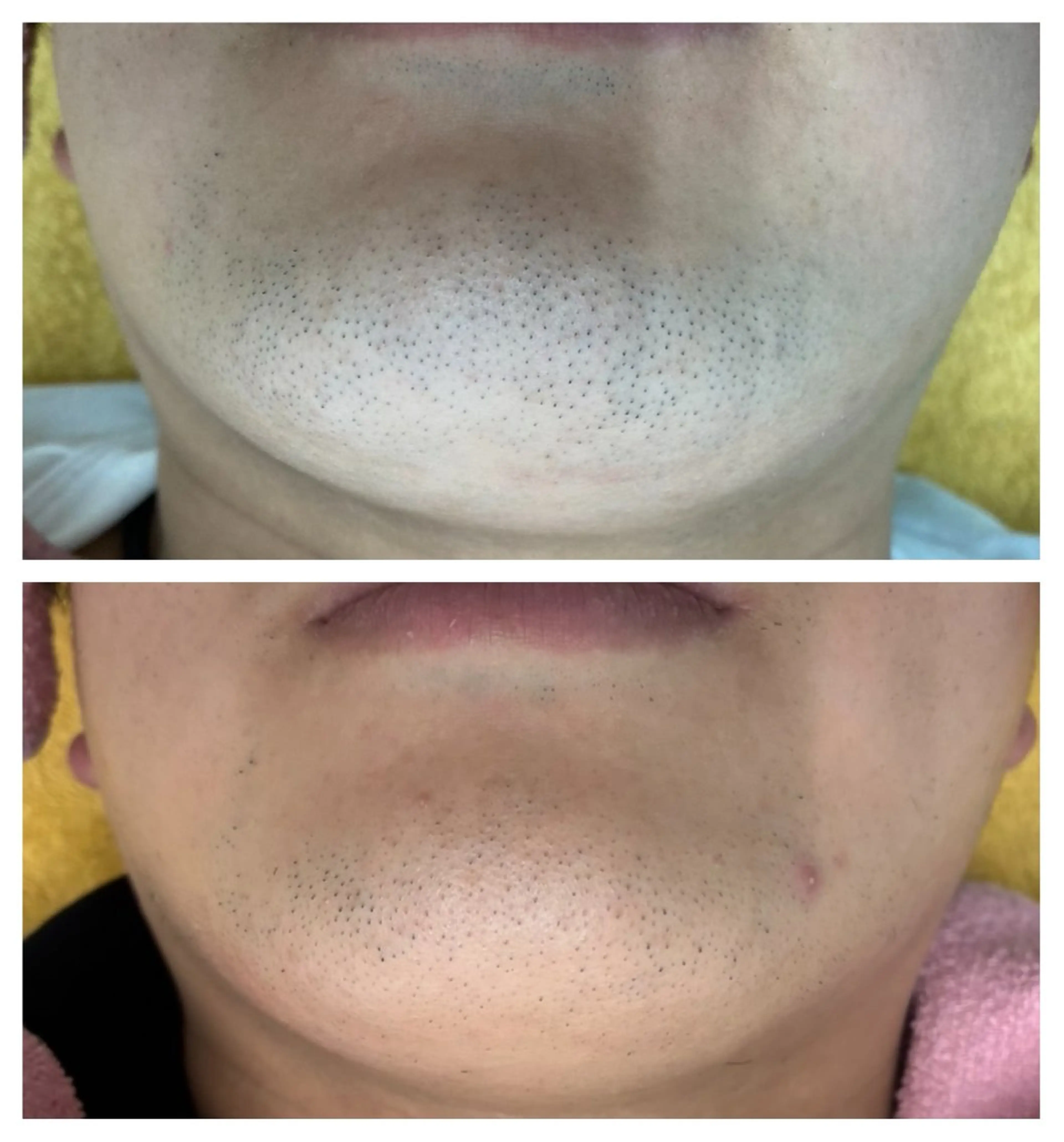 salon   de epilaのエステ・リラクイメージ