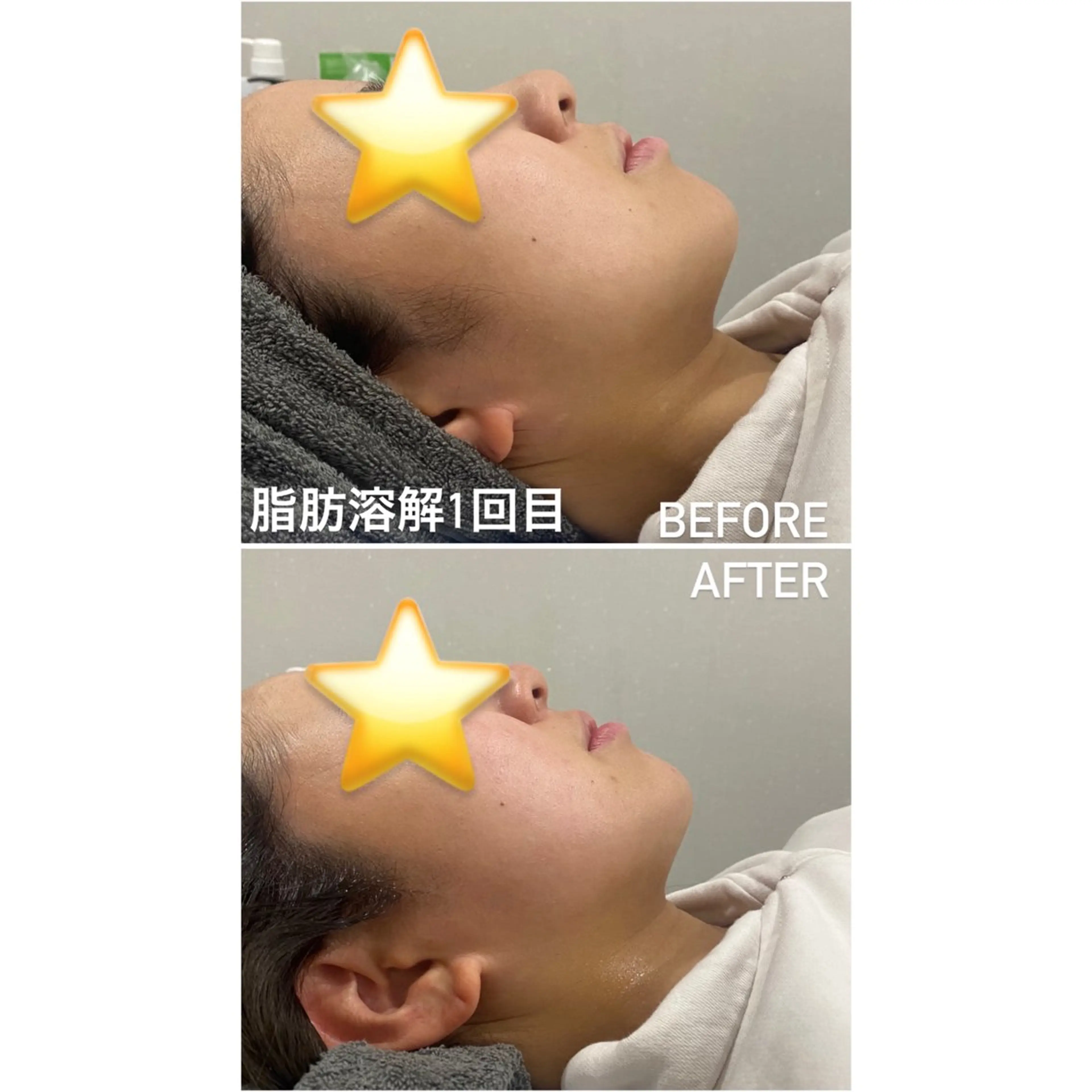 エステ 毛穴洗浄・痩身・脱毛 /アルカンジュのエステ・リラクイメージ