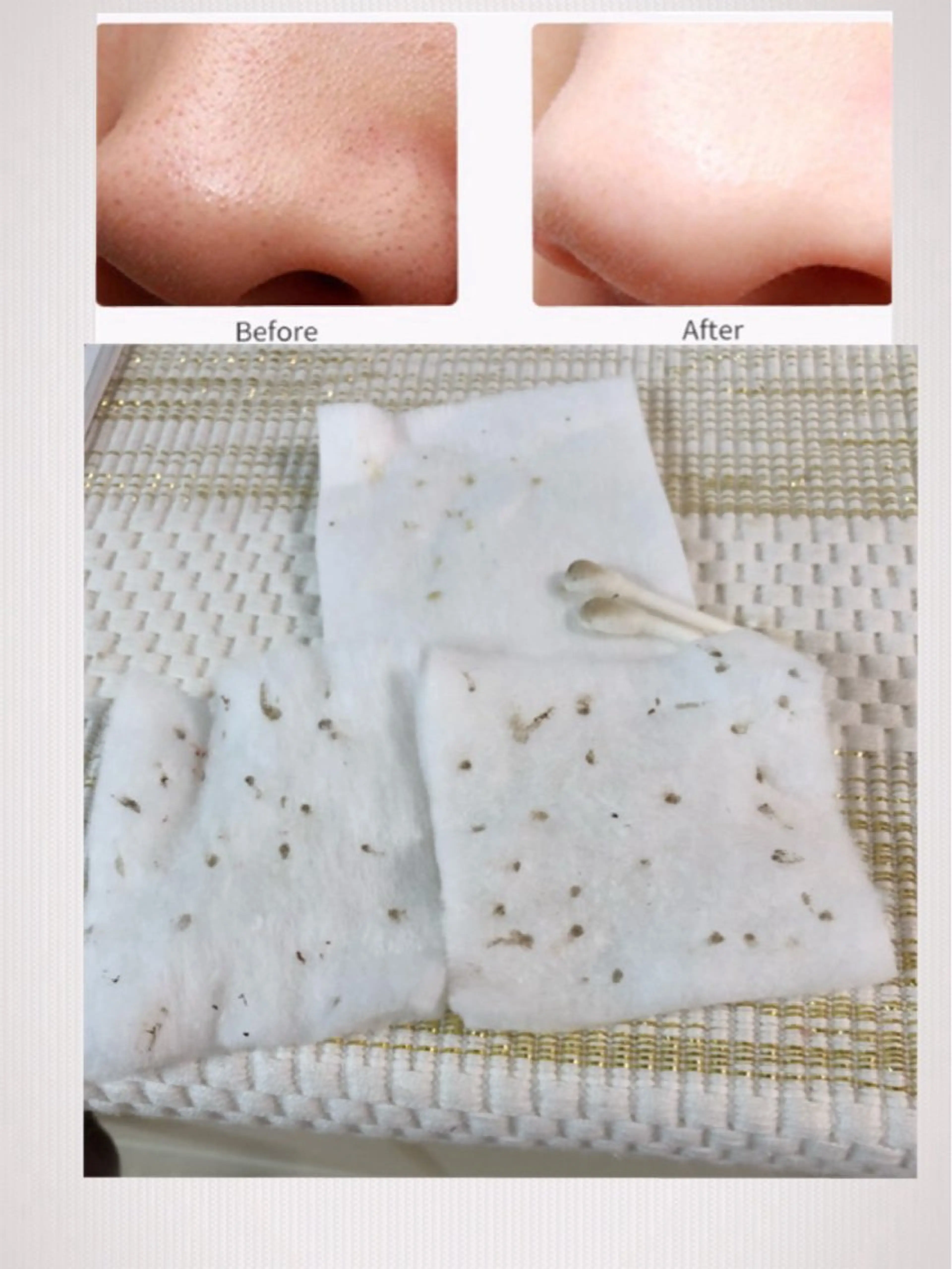 さよならいちご鼻!毛穴大掃除コース60分の写真