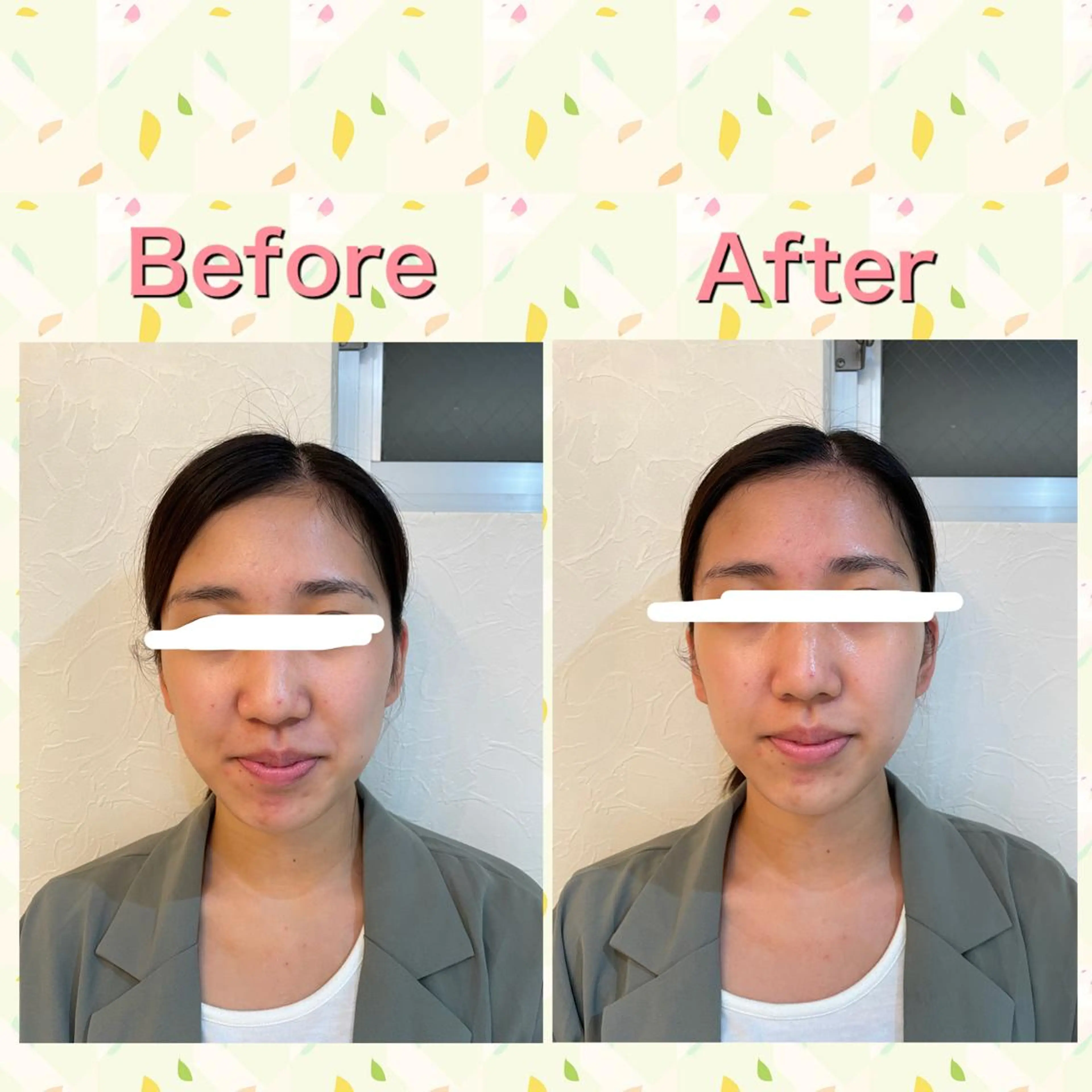 SUN&MOON REOのネイルデザイン