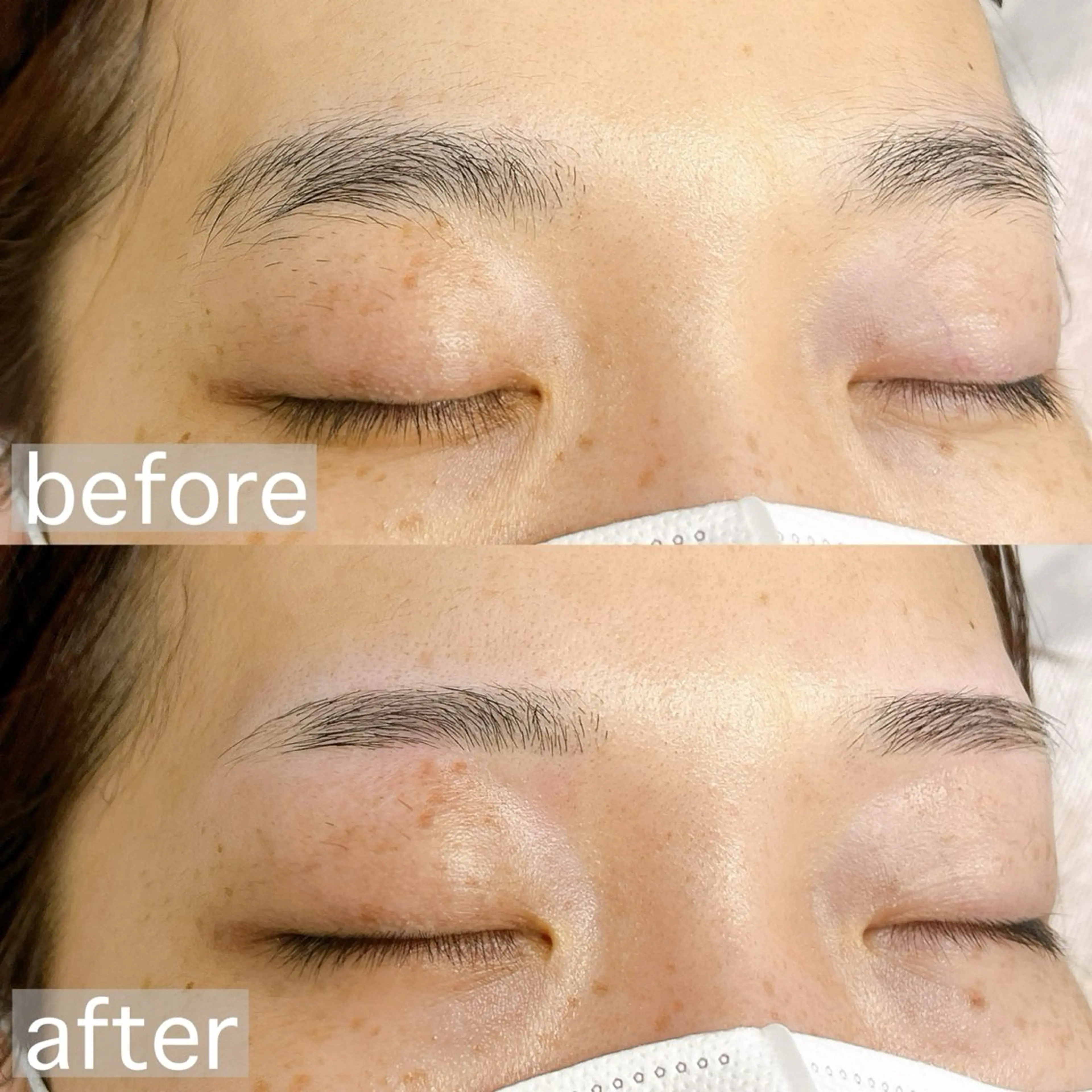 アイブロウ ワックス脱毛 アイブロウ&フェイシャルサロンa‘lm所属・WAX脱毛/肌質改善 眉毛とお肌のサロンのエステ・リラクイメージ