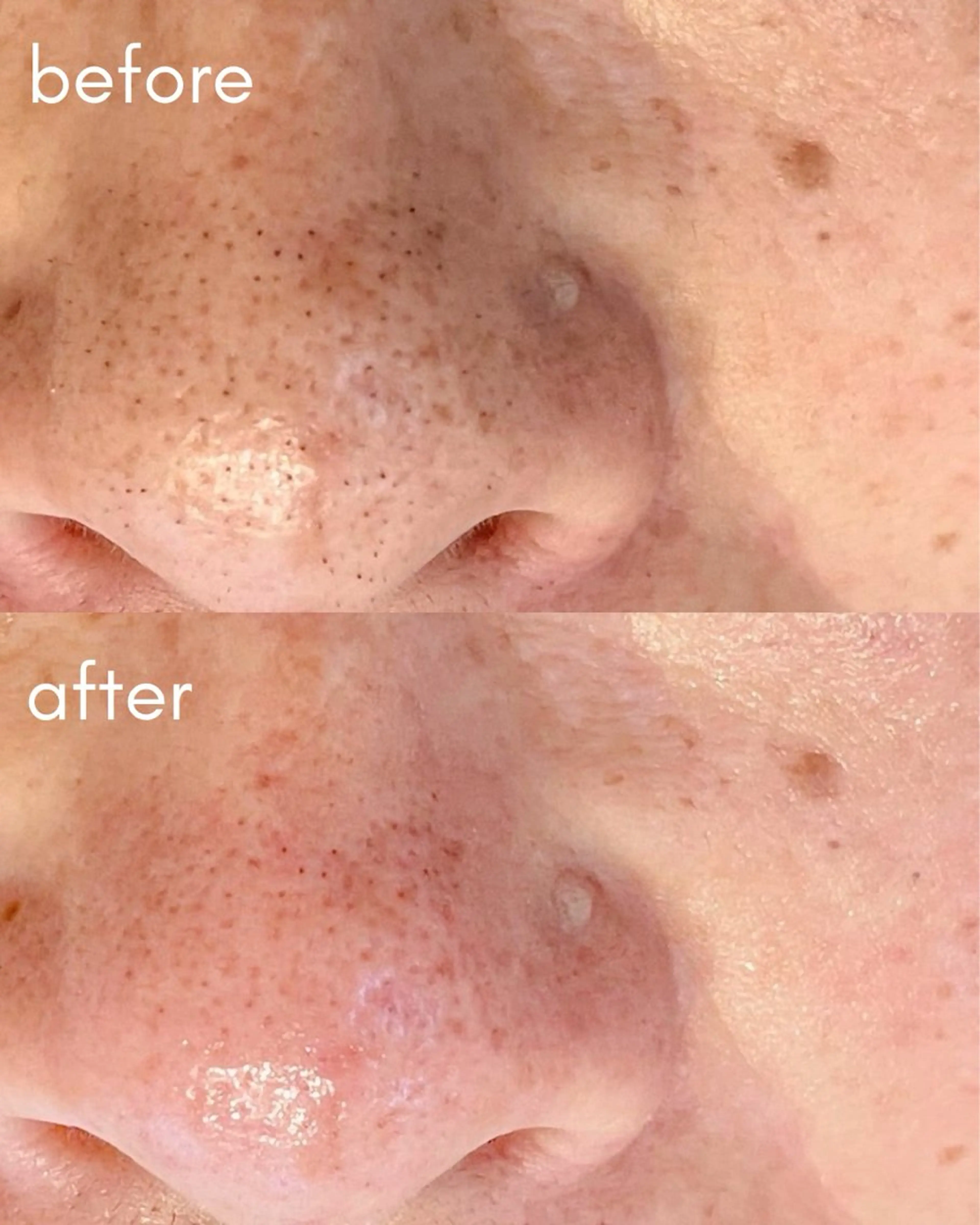 毛穴ケア専門サロン m&uのエステ・リラクイメージ