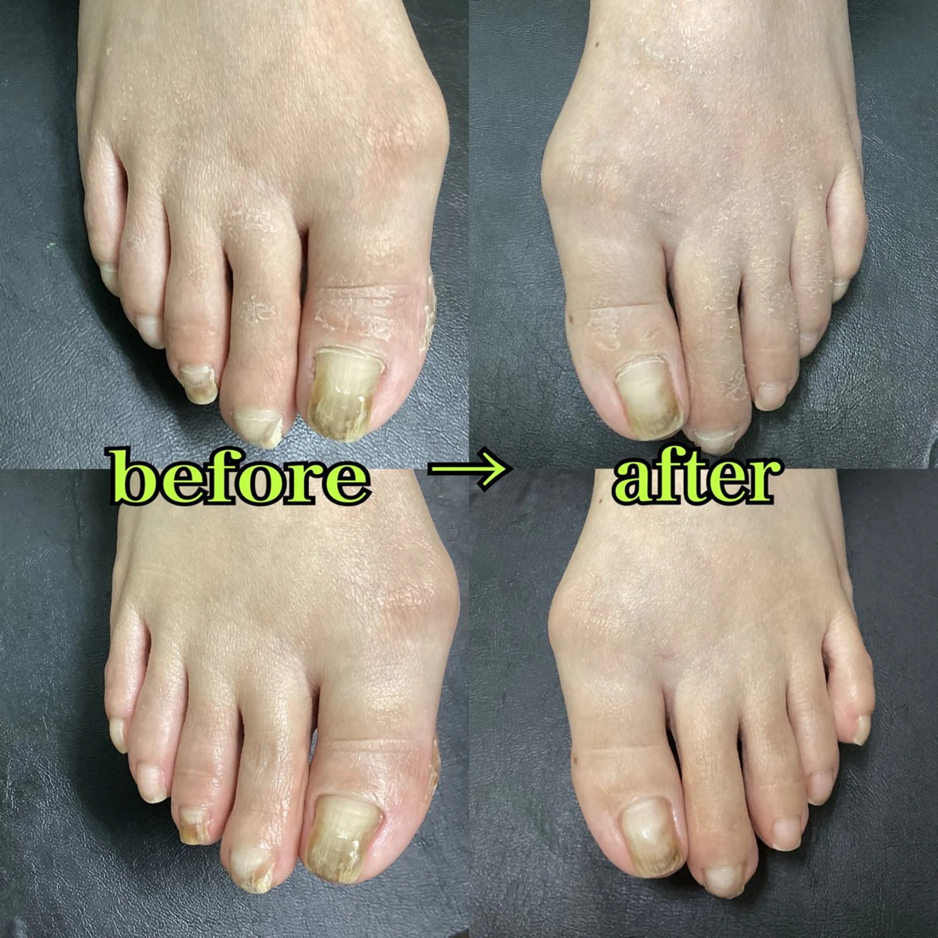 ネイル フットネイル リラク/ネイル/ 足裏ケア/蛭川栞のエステ・リラクイメージ