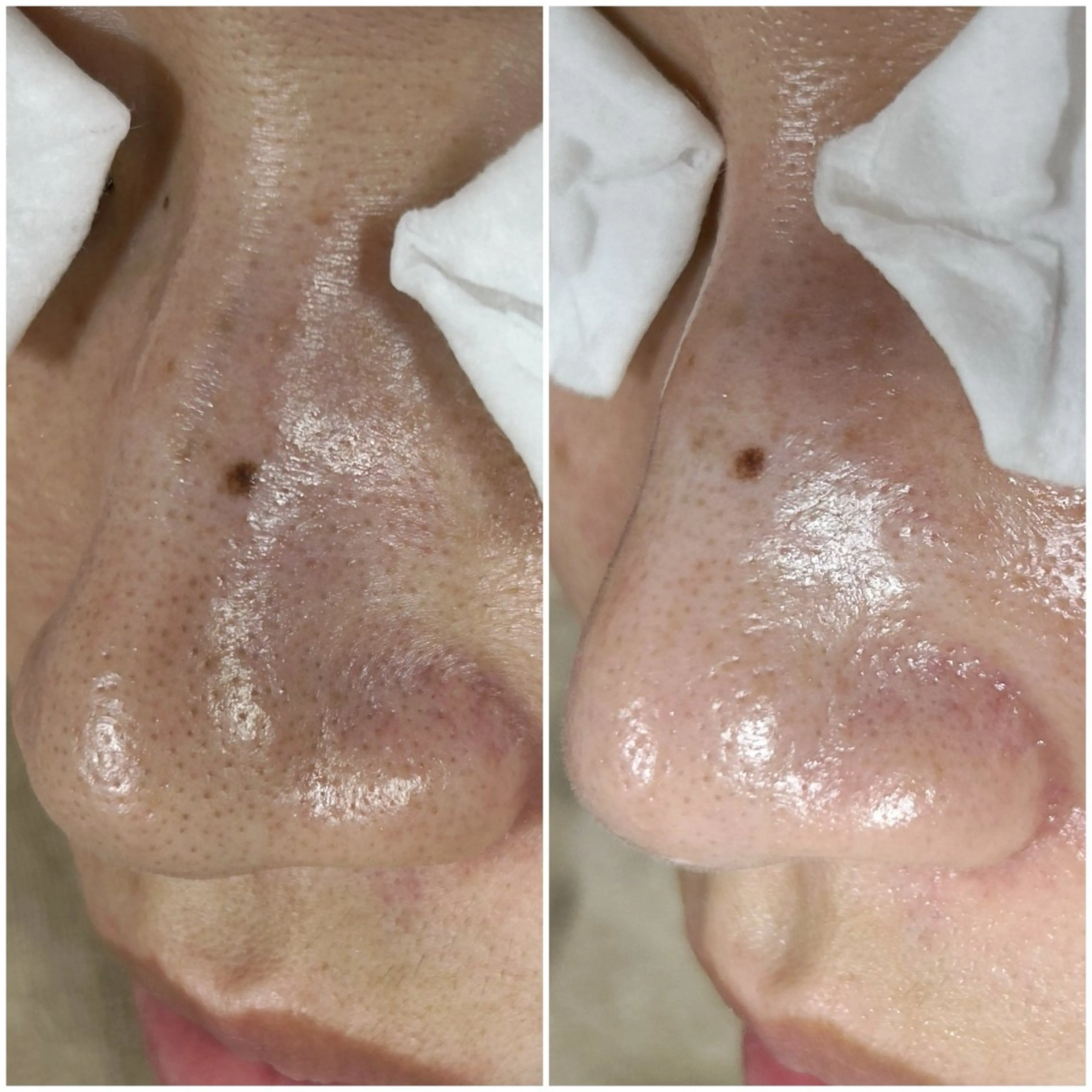 毛穴洗浄専門店/ 泉佐野/oluoluのエステ・リラクイメージ