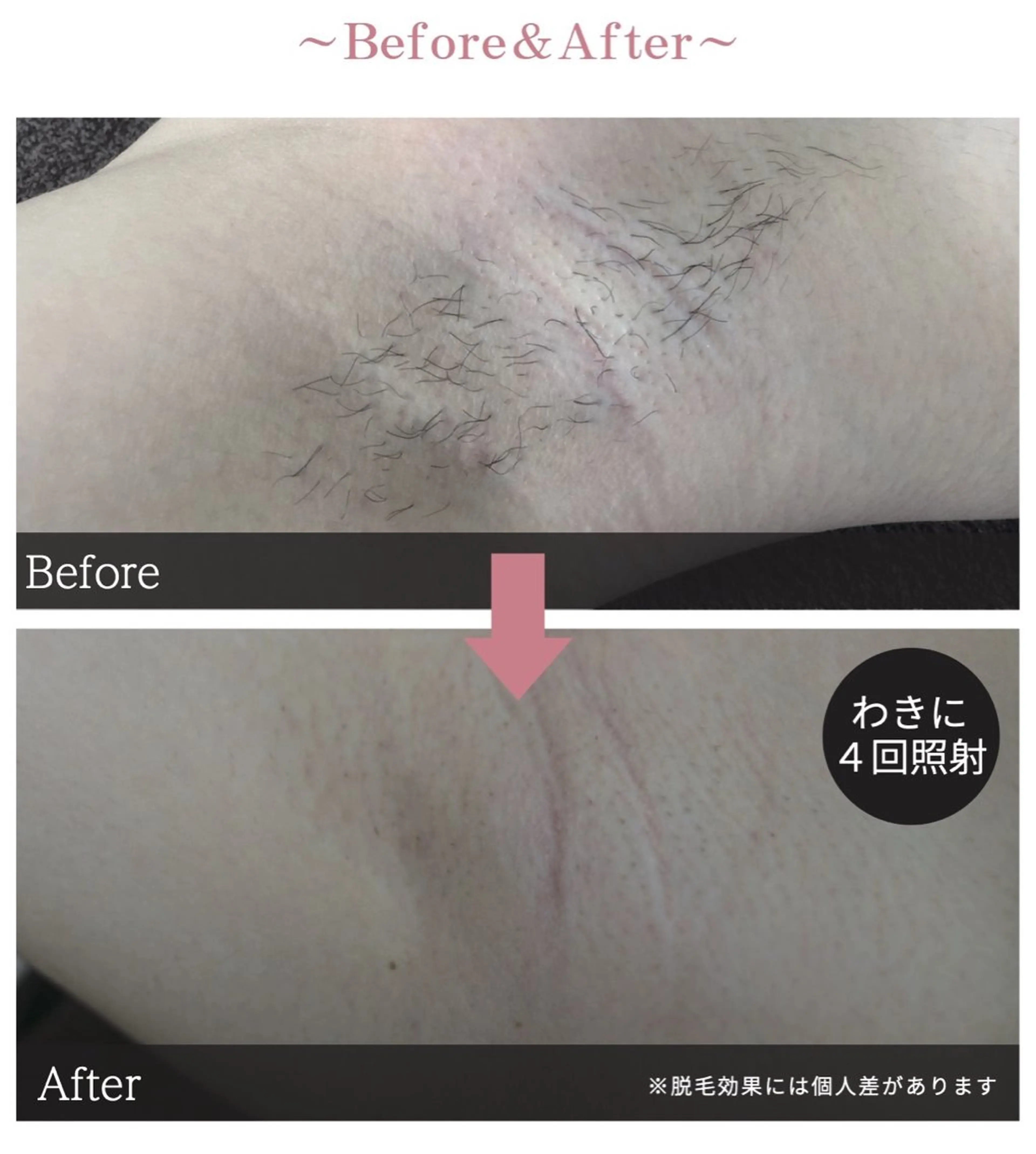 Reizend 🌿 ライチェンドのエステ・リラクイメージ