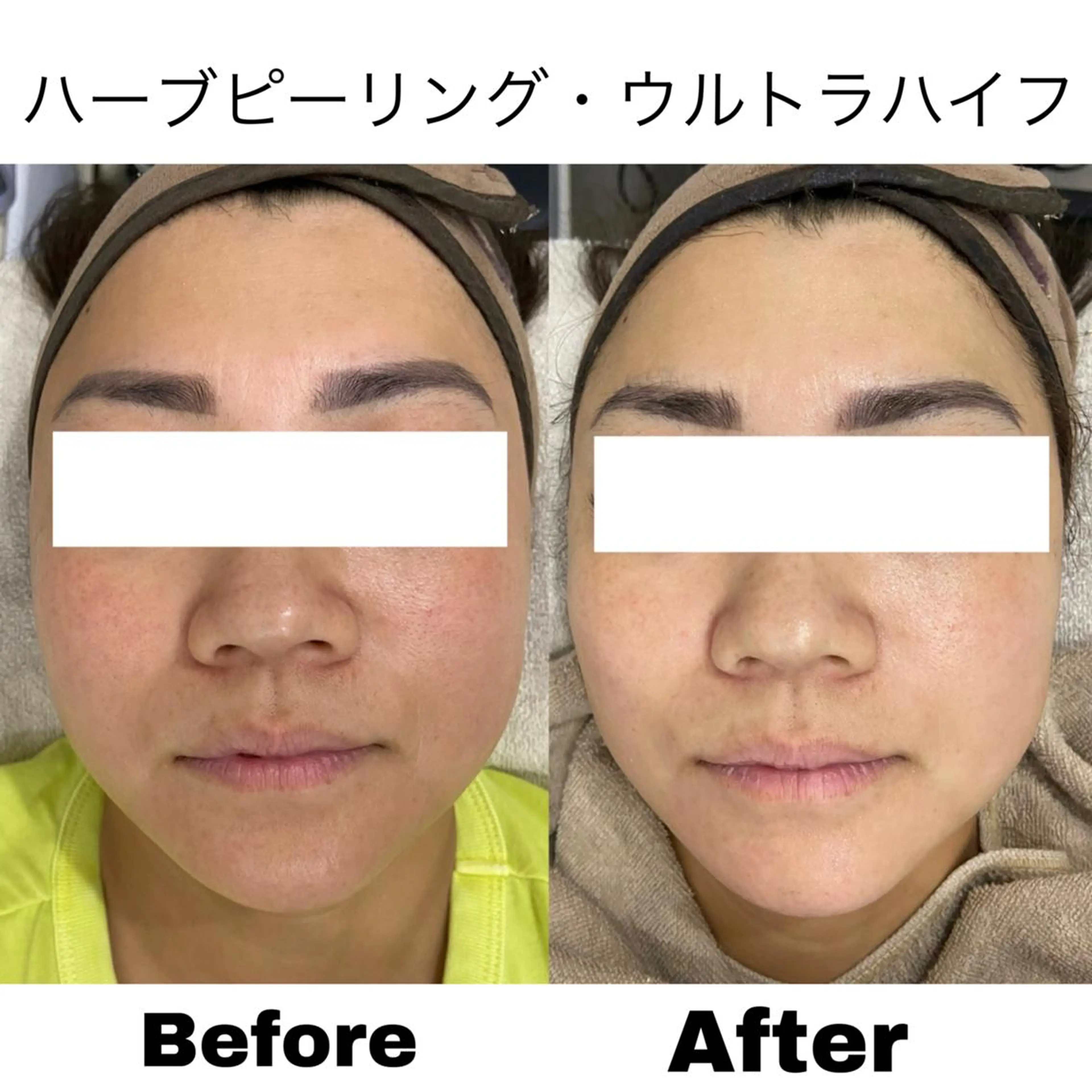 美肌サロンTIAM by tetoteのエステ・リラクイメージ