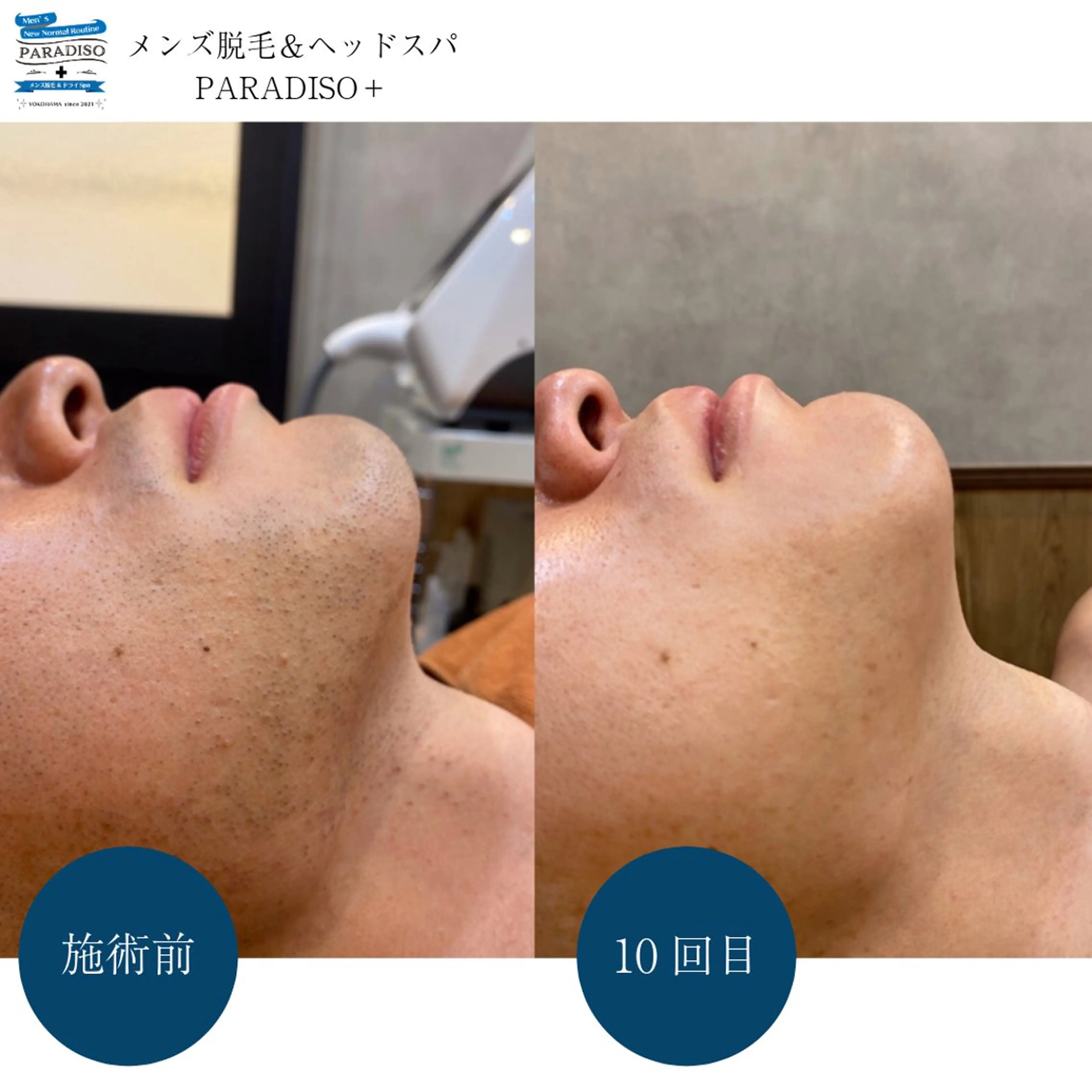 メンズ 後藤 まりやの眉毛・アイブロウイメージ