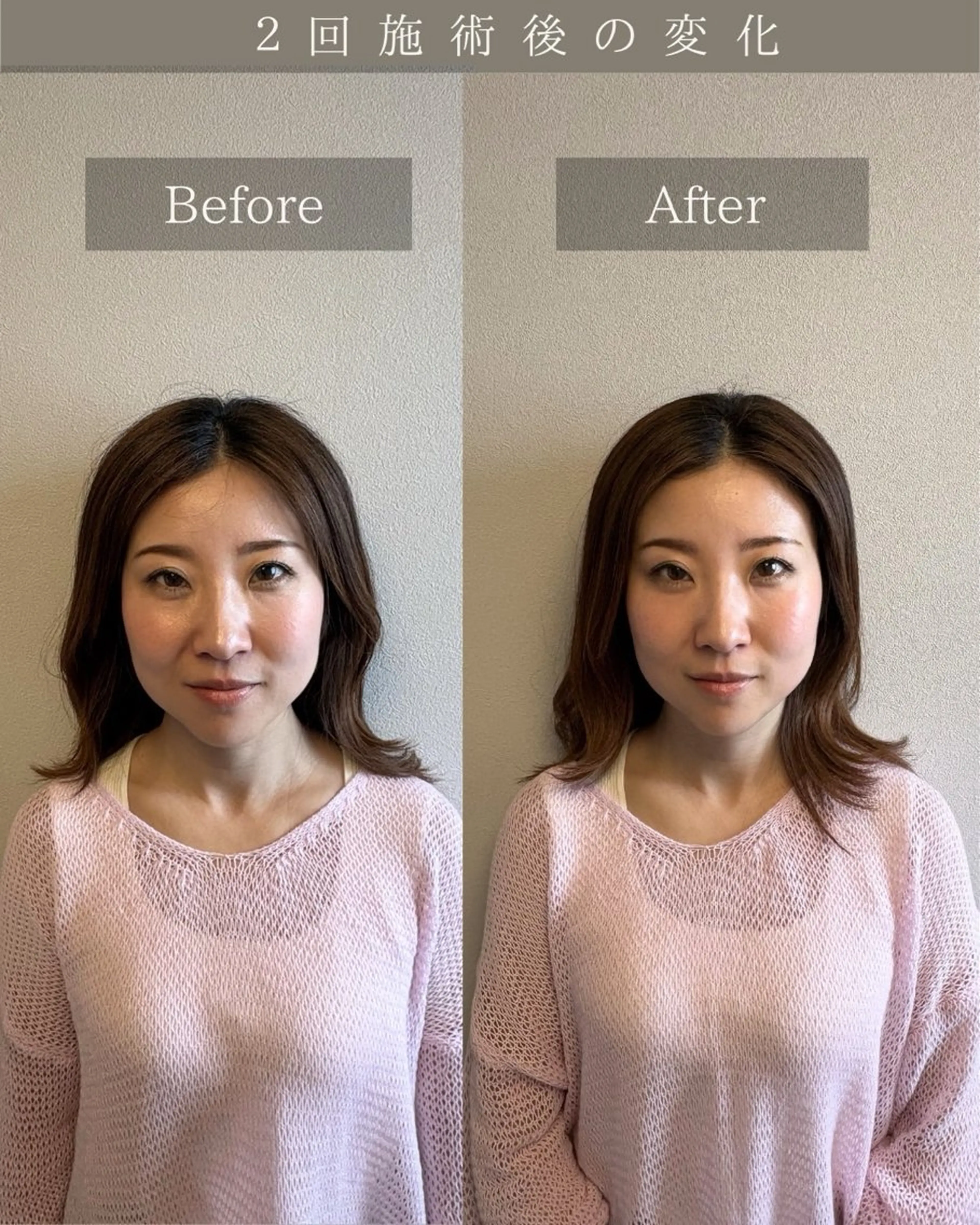 美肌&小顔矯正 Noelieのエステ・リラクイメージ