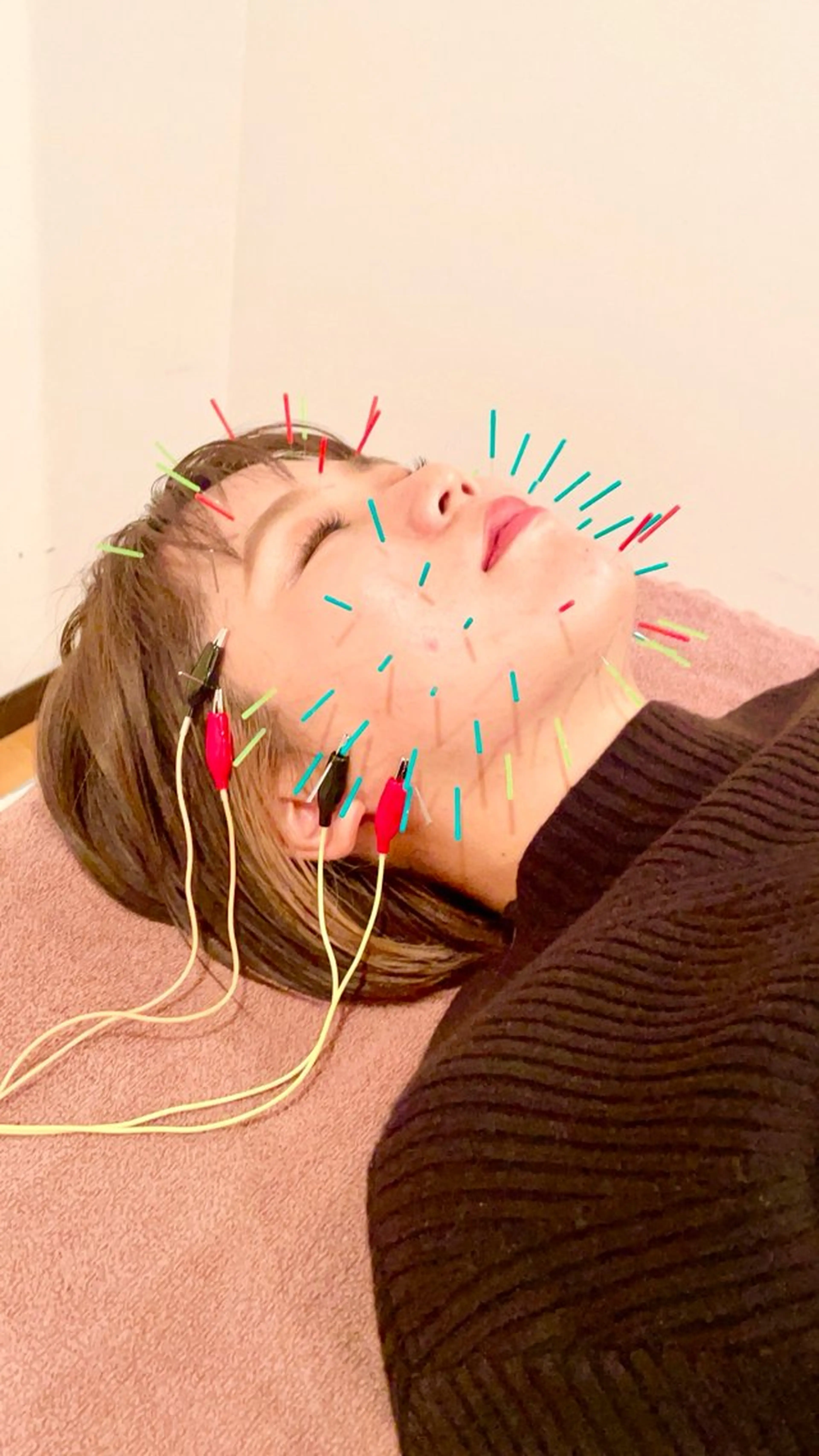 鍼灸サロン TIARA　美容鍼のエステ・リラクイメージ