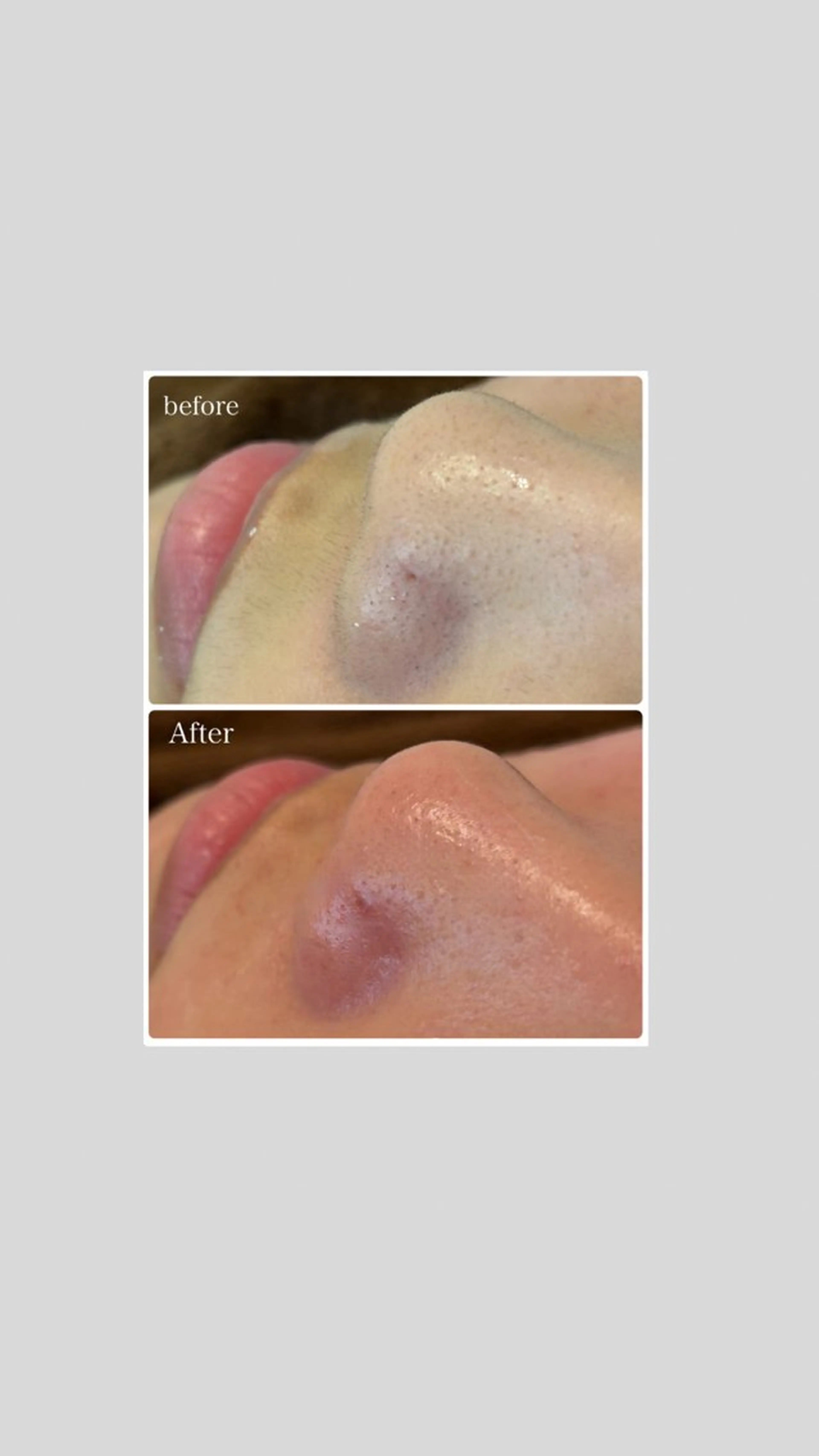 エステ リラク 韓国肌管理 【毛穴専科】のエステ・リラクイメージ