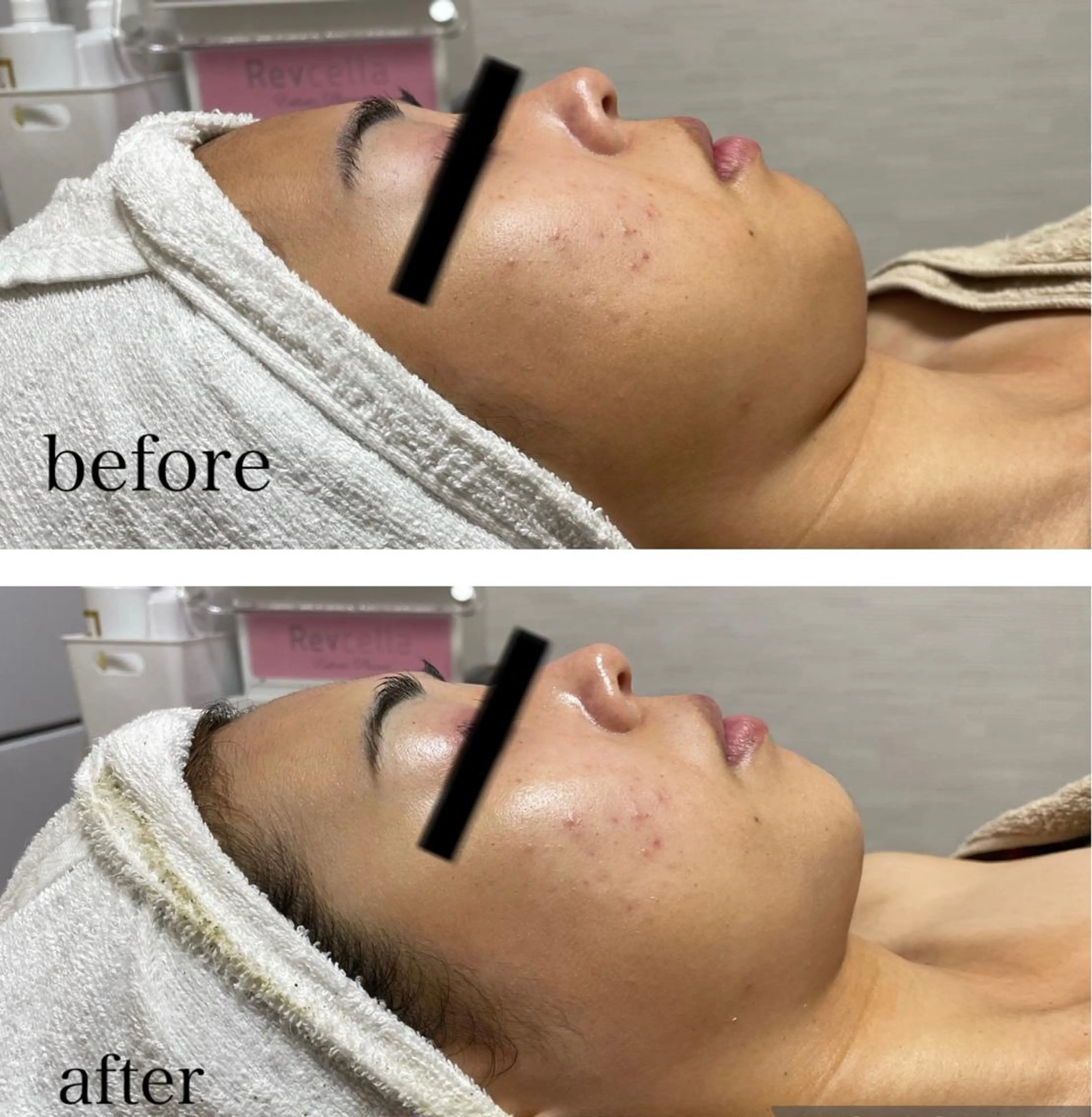 ビューティーサロン B.glossyのネイルデザイン