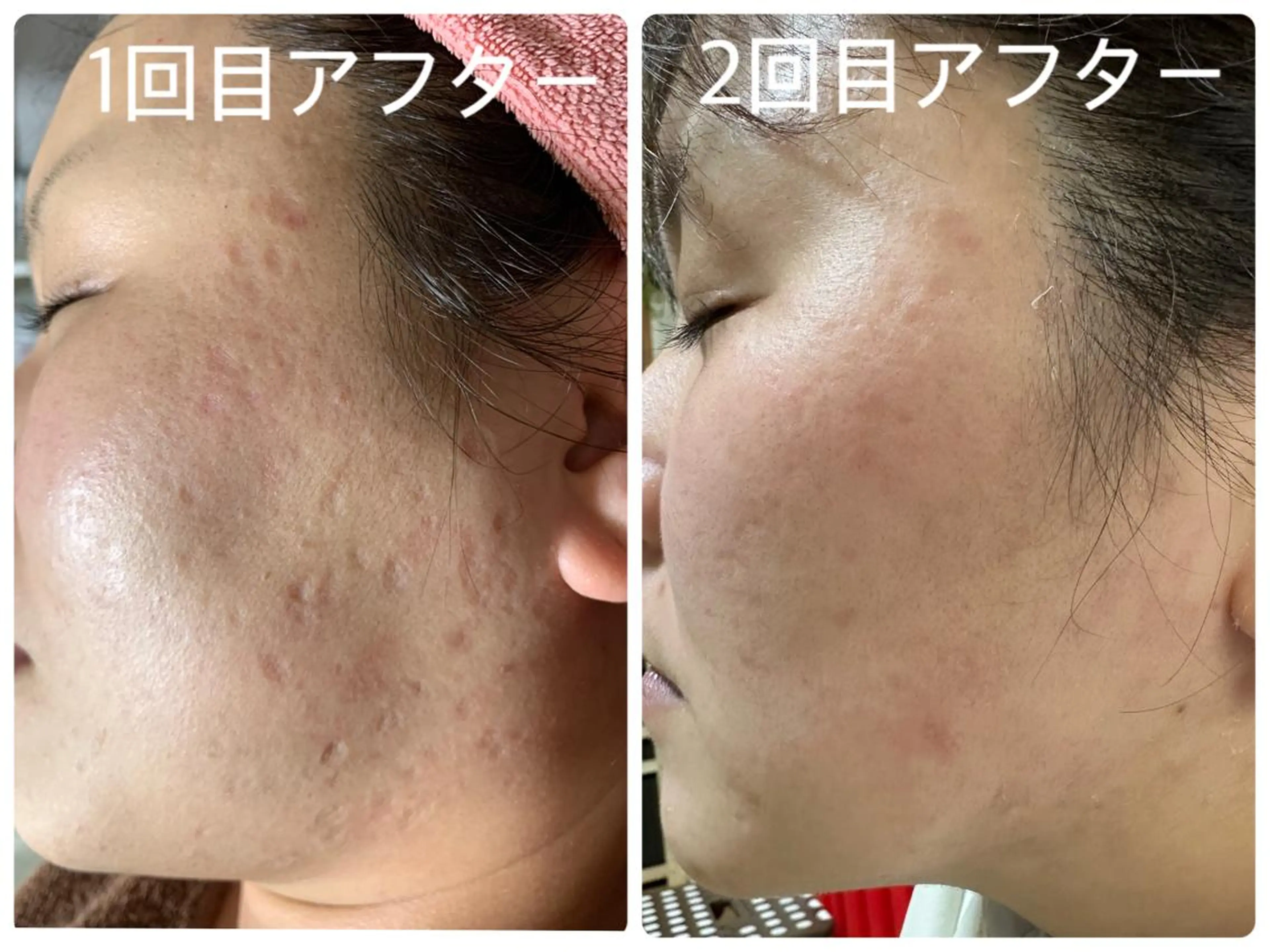 エステ デトックス専門サロン ココシュエットのエステ・リラクイメージ