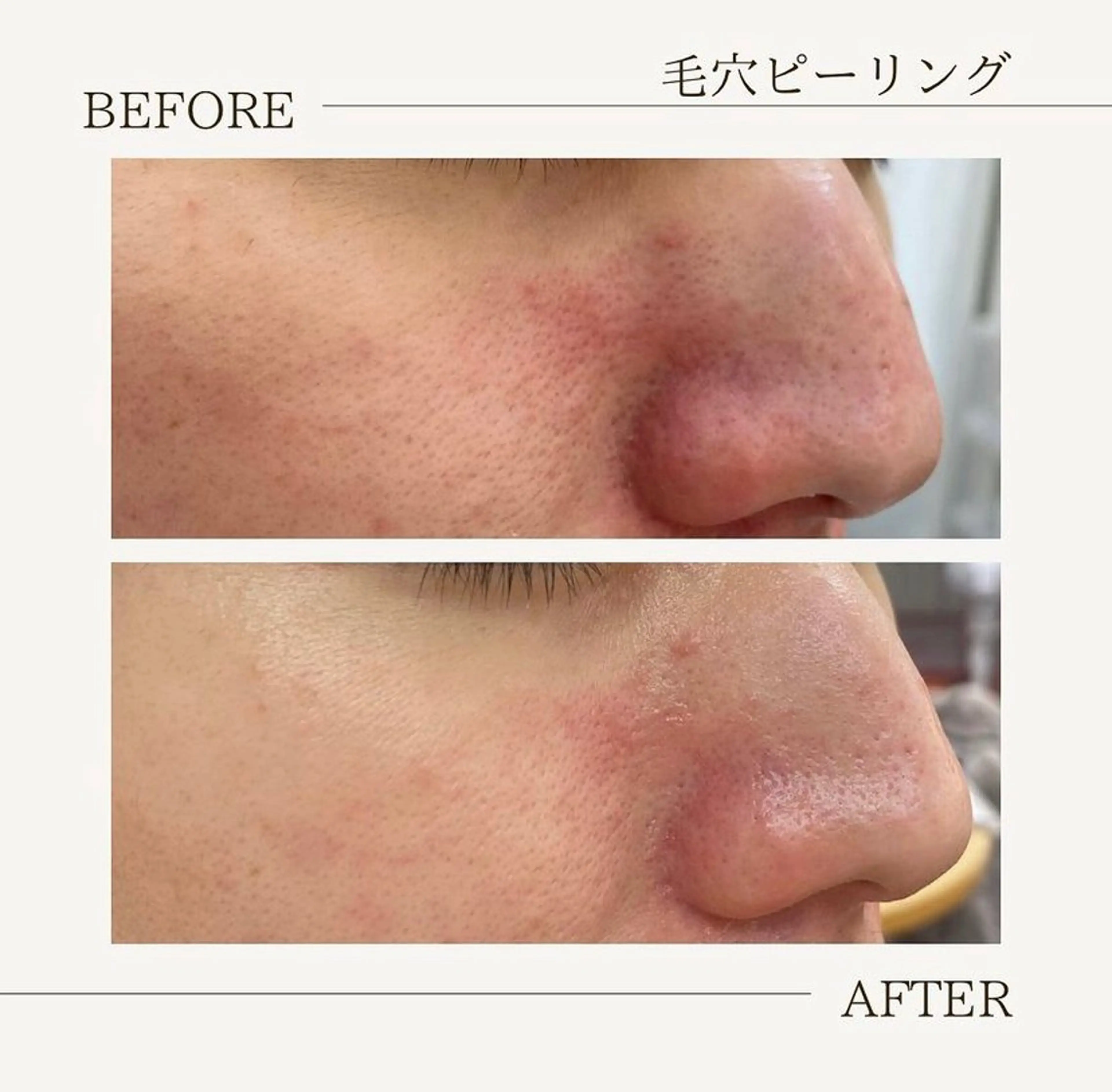 肌育成サロン ♡ RISAのエステ・リラクイメージ