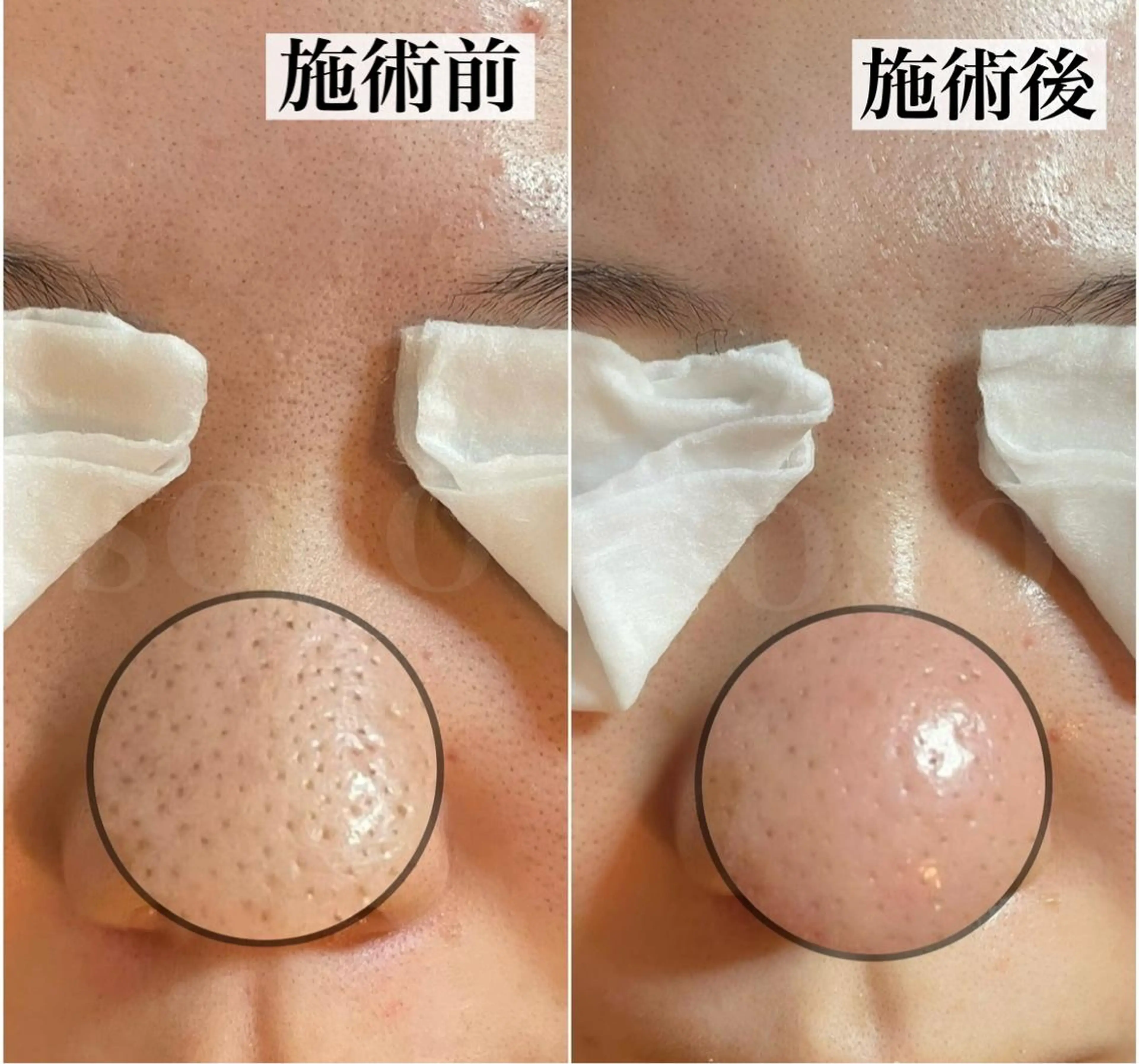 エステ salon soso(ソソ)のエステ・リラクイメージ