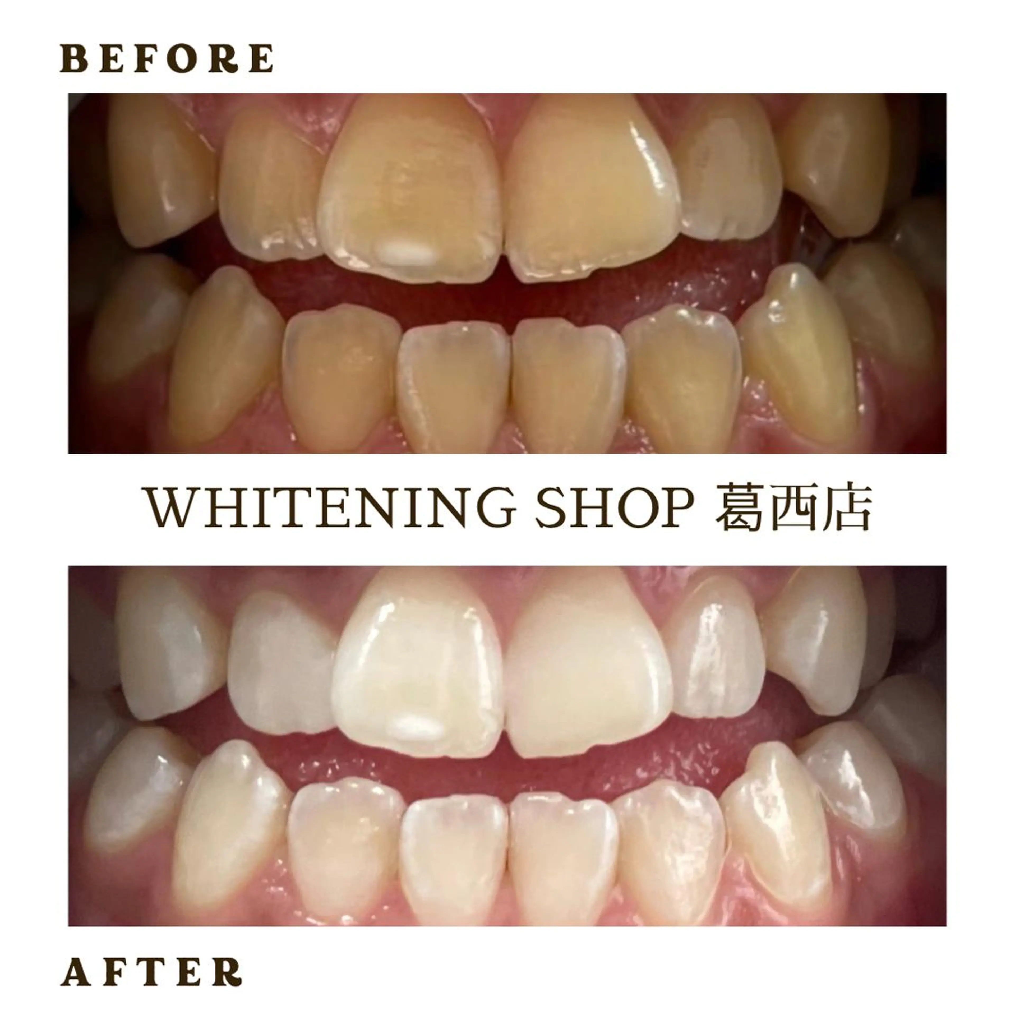 メンズ その他 ホワイトニング ショップ葛西店のその他イメージ