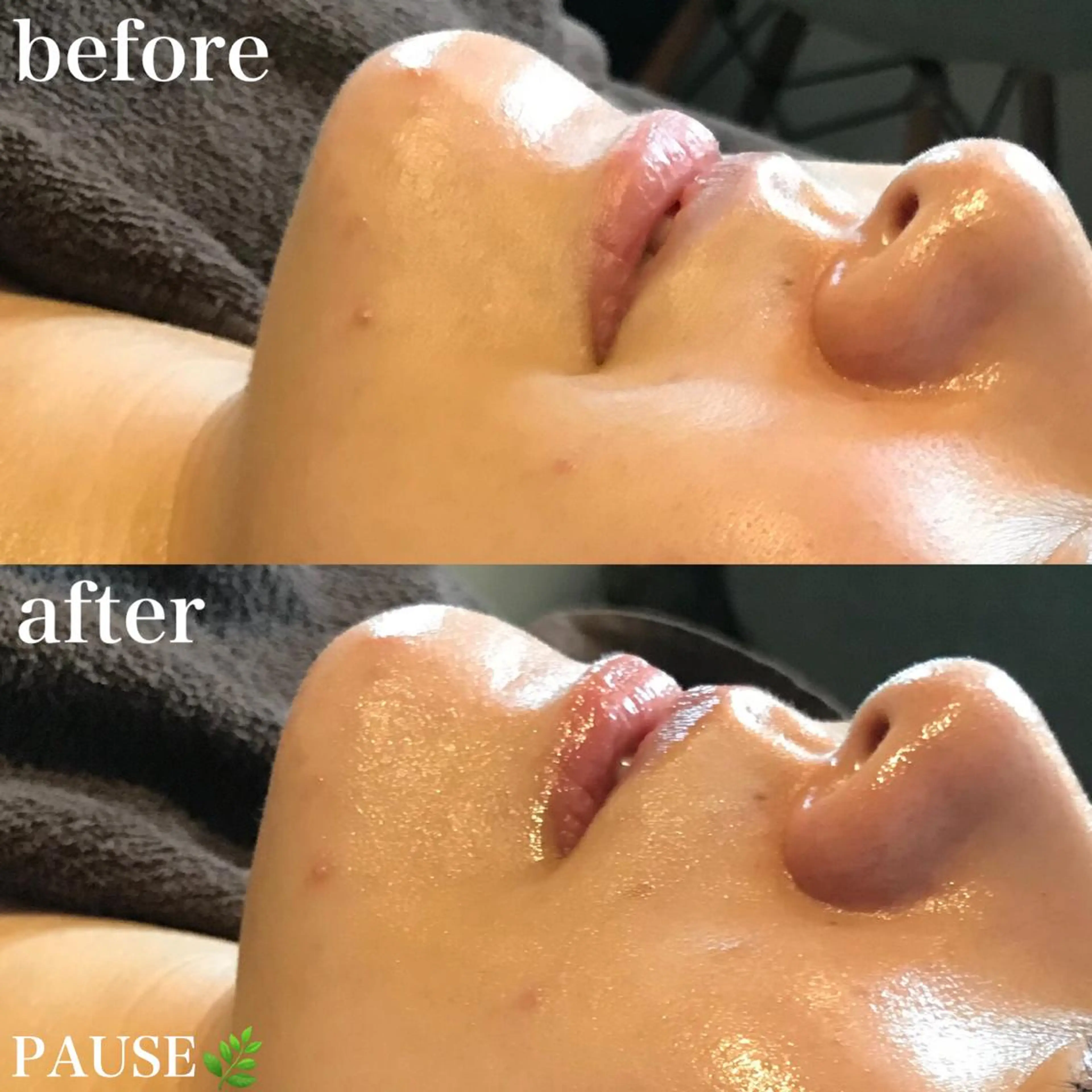 エステ 浜野 恵美のエステ・リラクイメージ