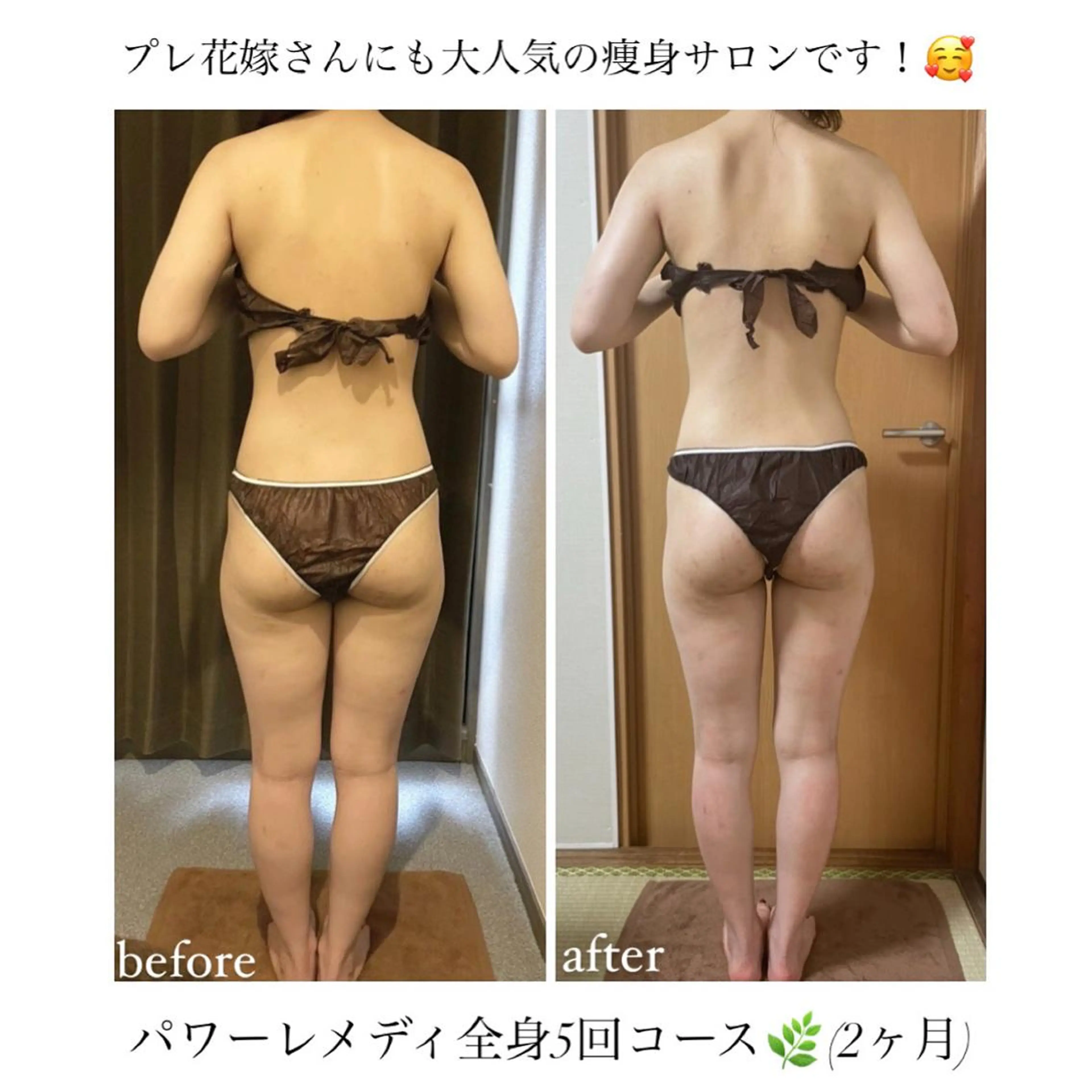 《本気痩せ×疲労改善 》  BILOOPのエステ・リラクイメージ