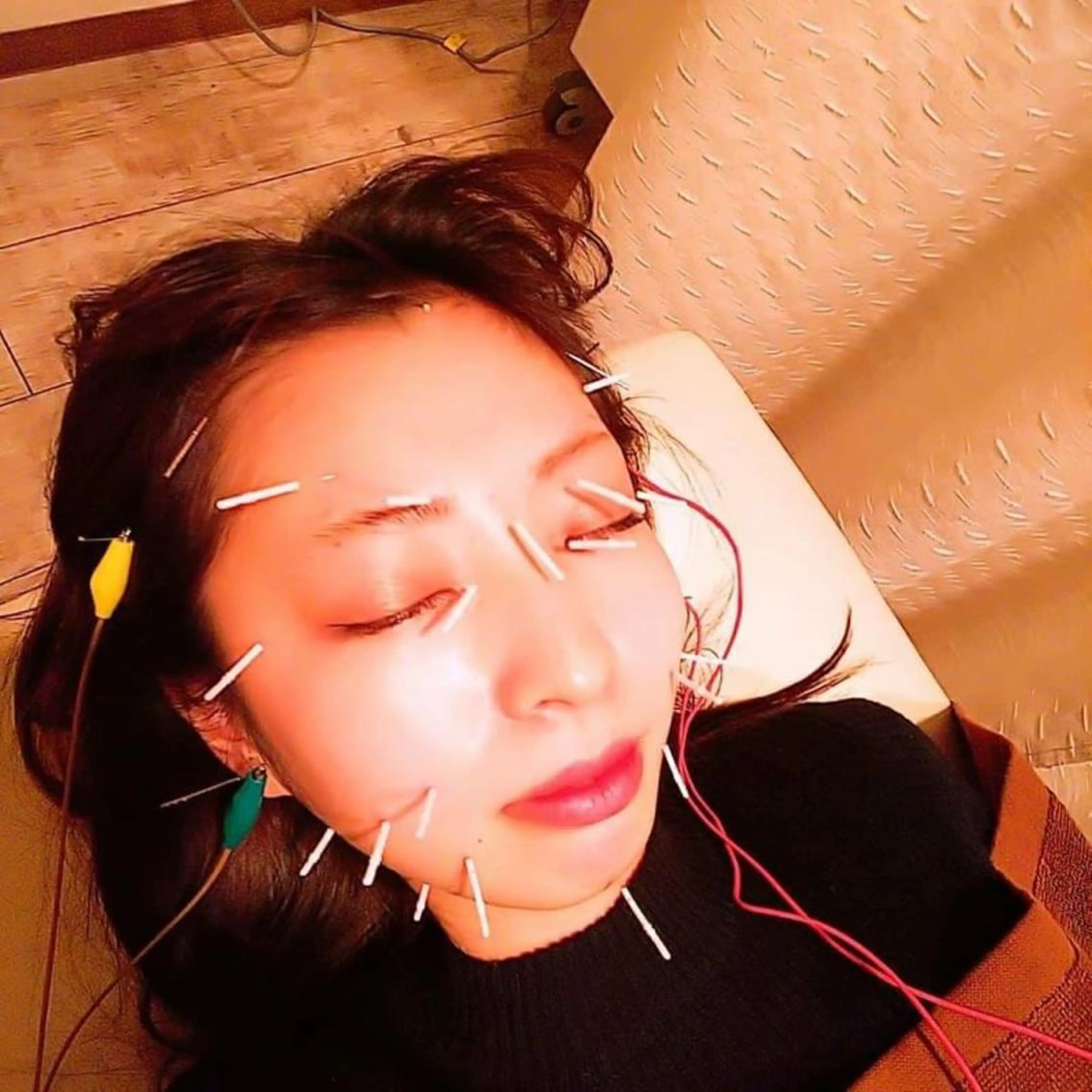 むくみたるみ専門☆ 美容鍼・小顔矯正のエステ・リラクイメージ