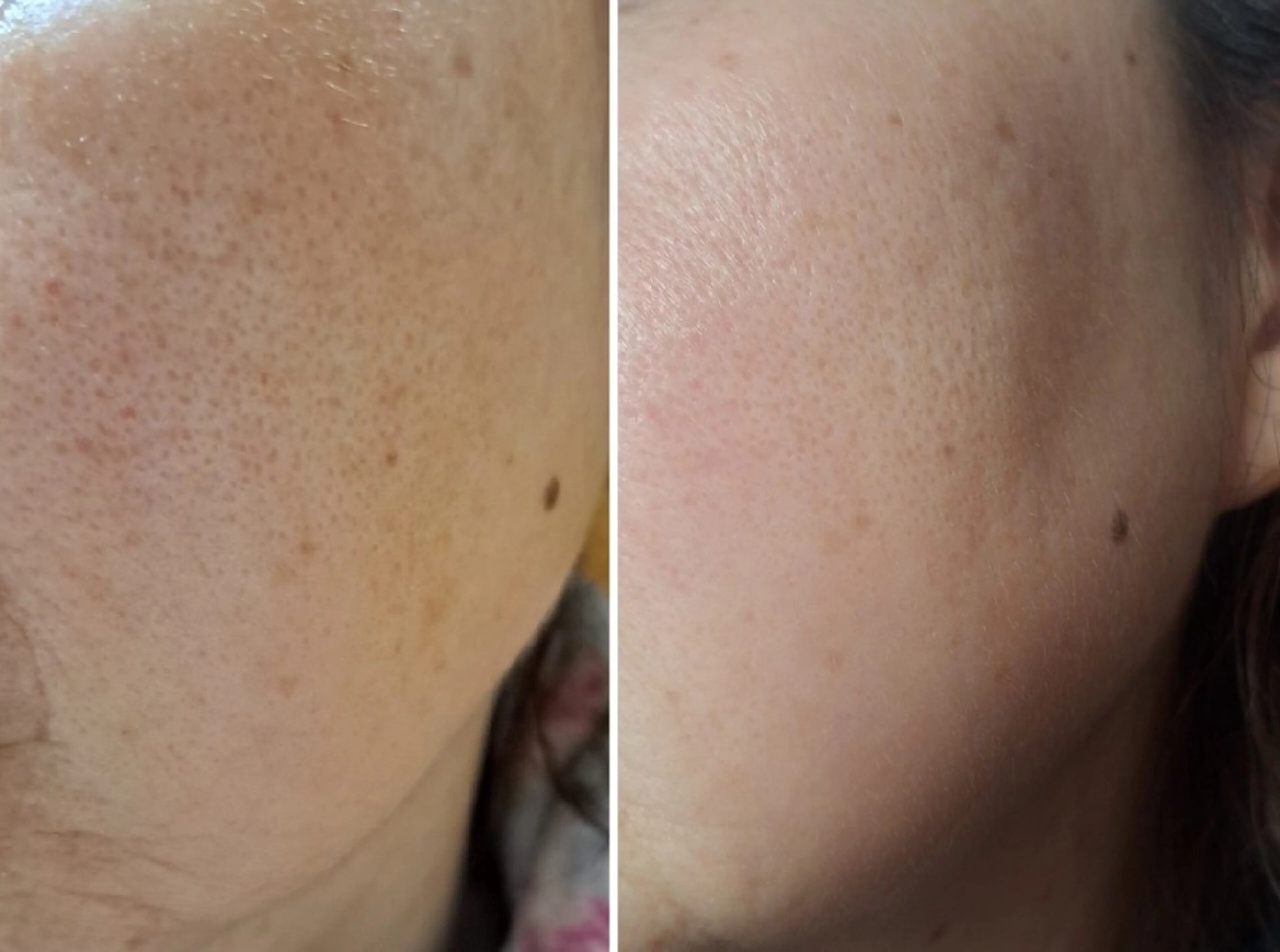 エステ 辻村 晴美のエステ・リラクイメージ