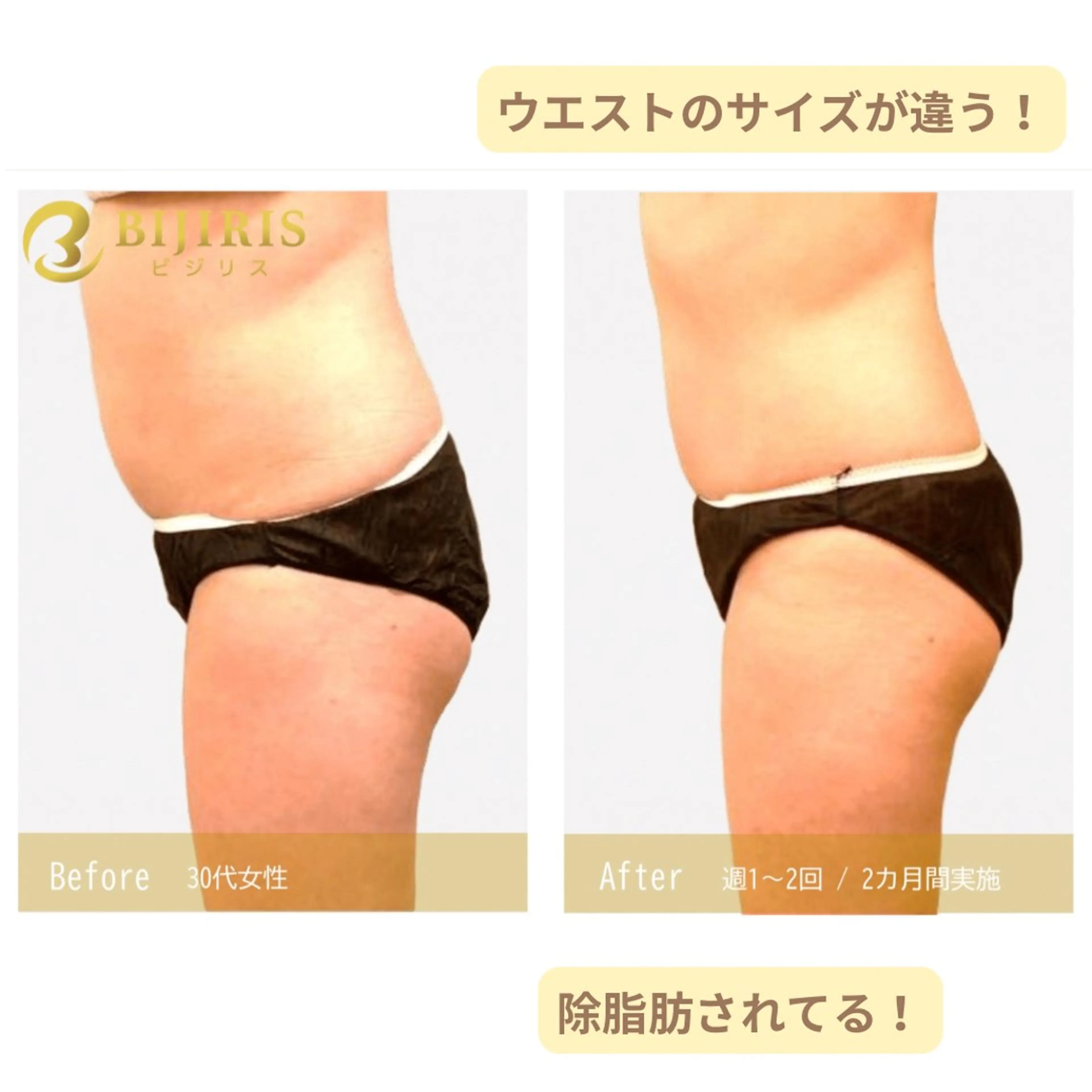 セルフ脱毛/美尻イス キングスサロン熊本のエステ・リラクイメージ