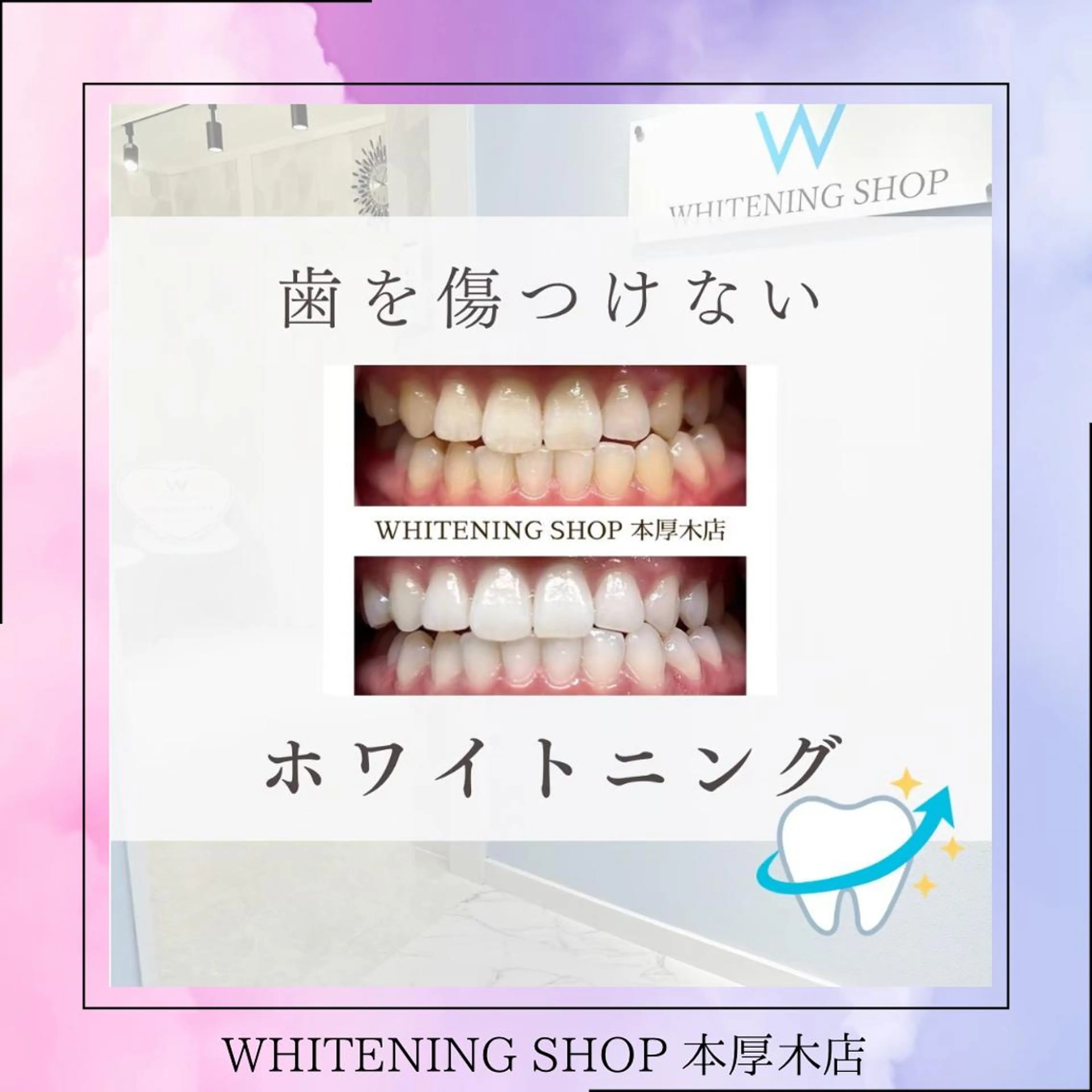 メンズ その他 ホワイトニング ショップ本厚木のその他イメージ