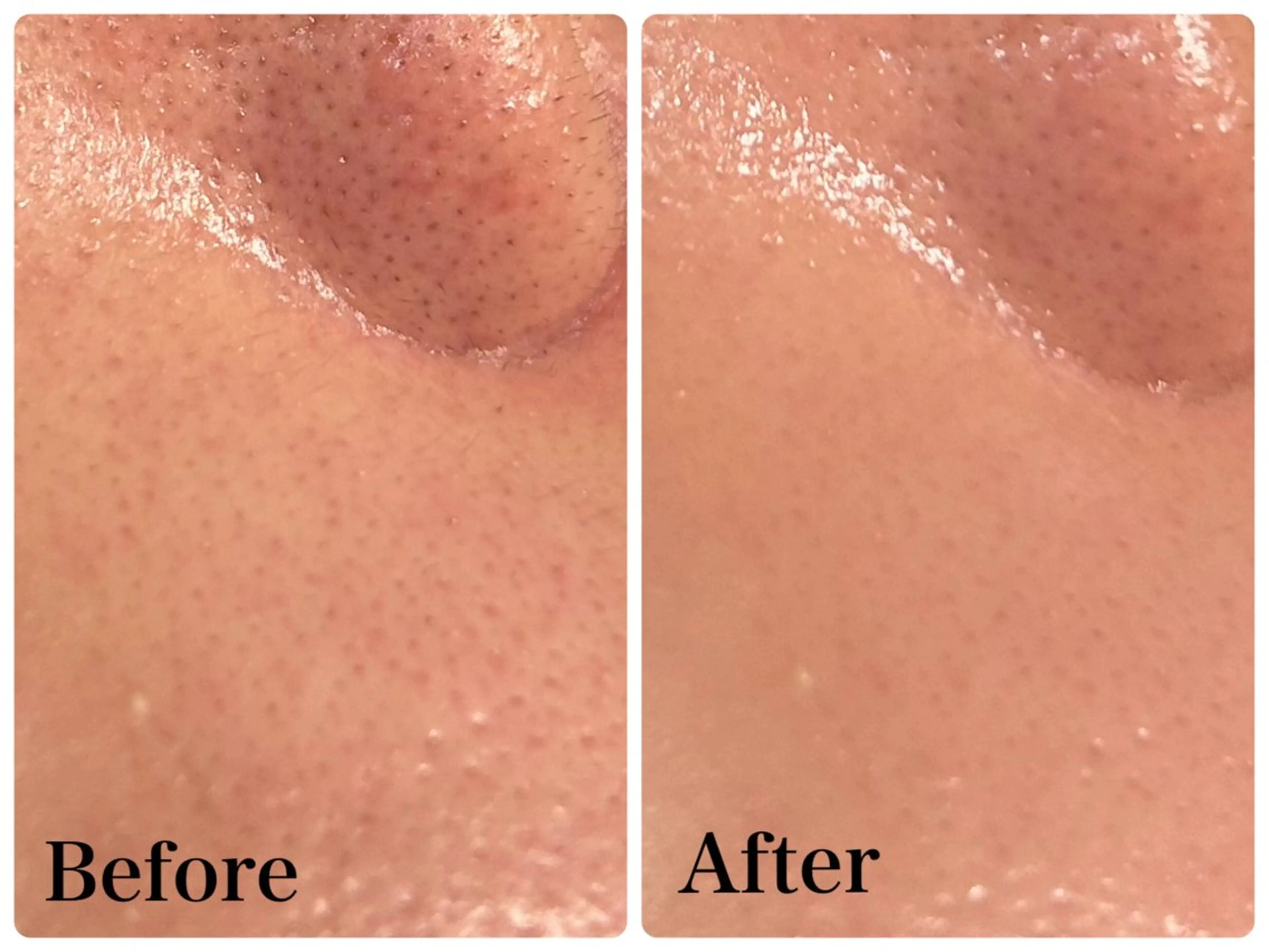 エステ Gemini 　MIKIのエステ・リラクイメージ