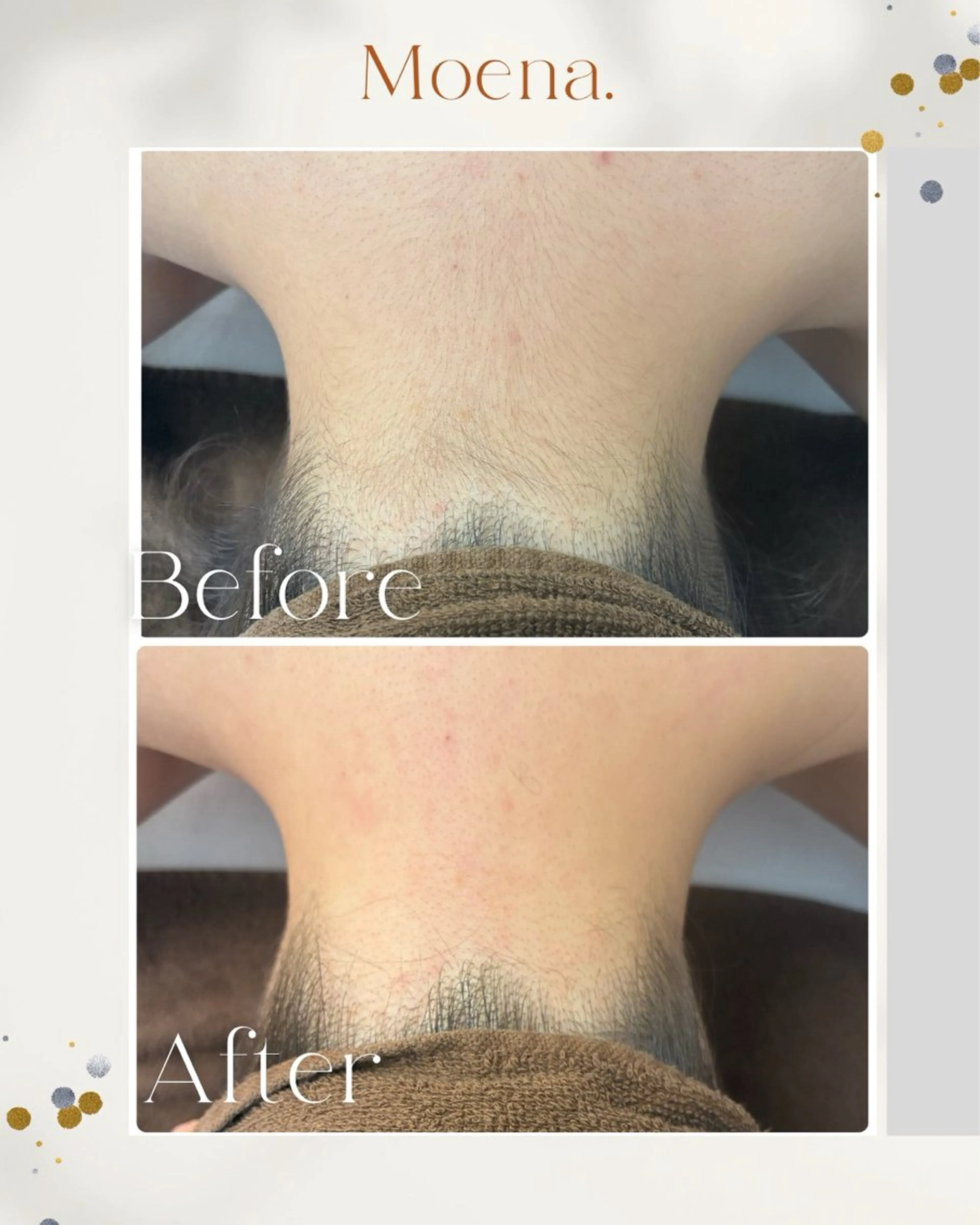 Moena. 武蔵小杉🫧のエステ・リラクイメージ