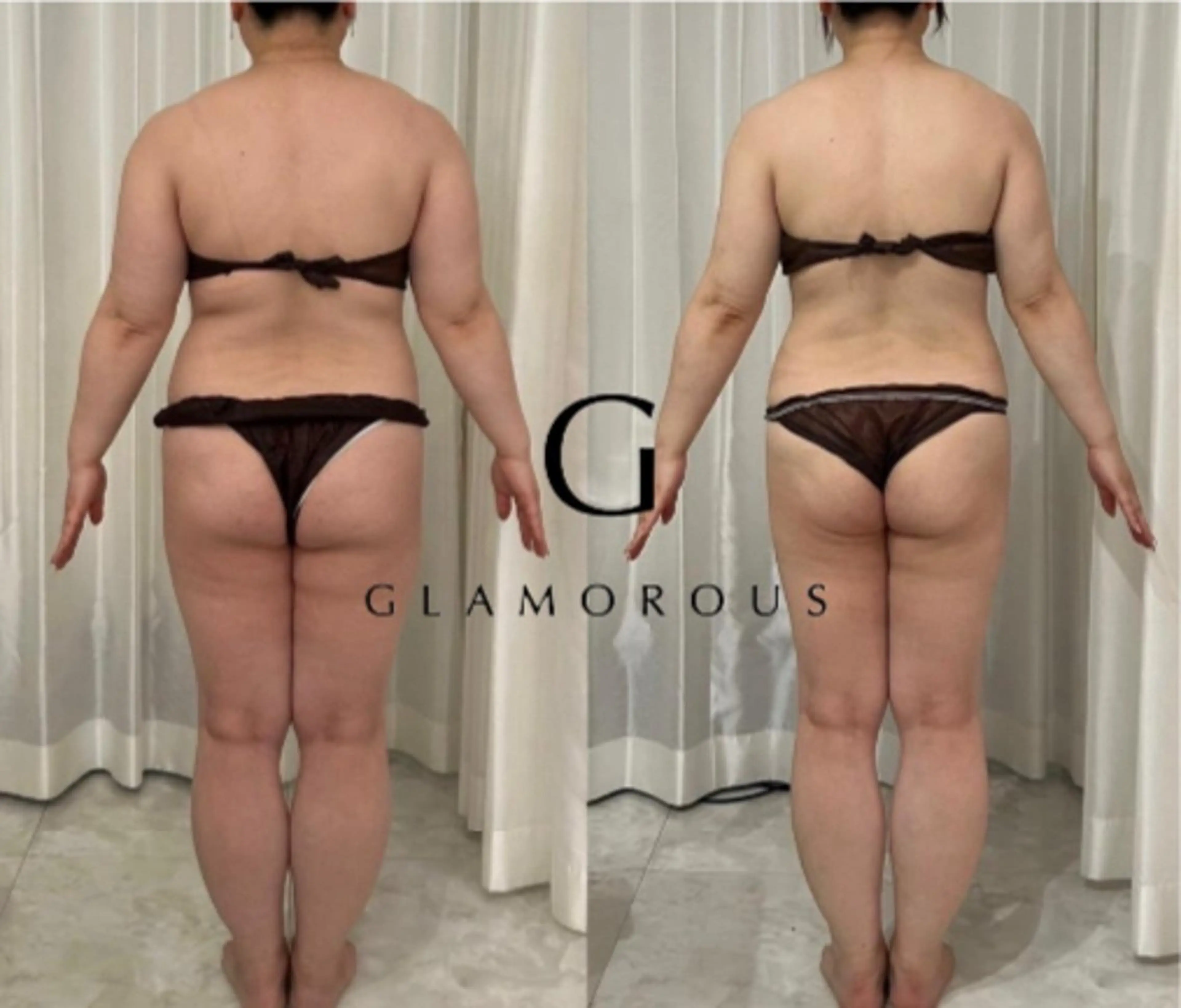 Pono所属・Pono （ポノ）のエステ・リラクイメージ