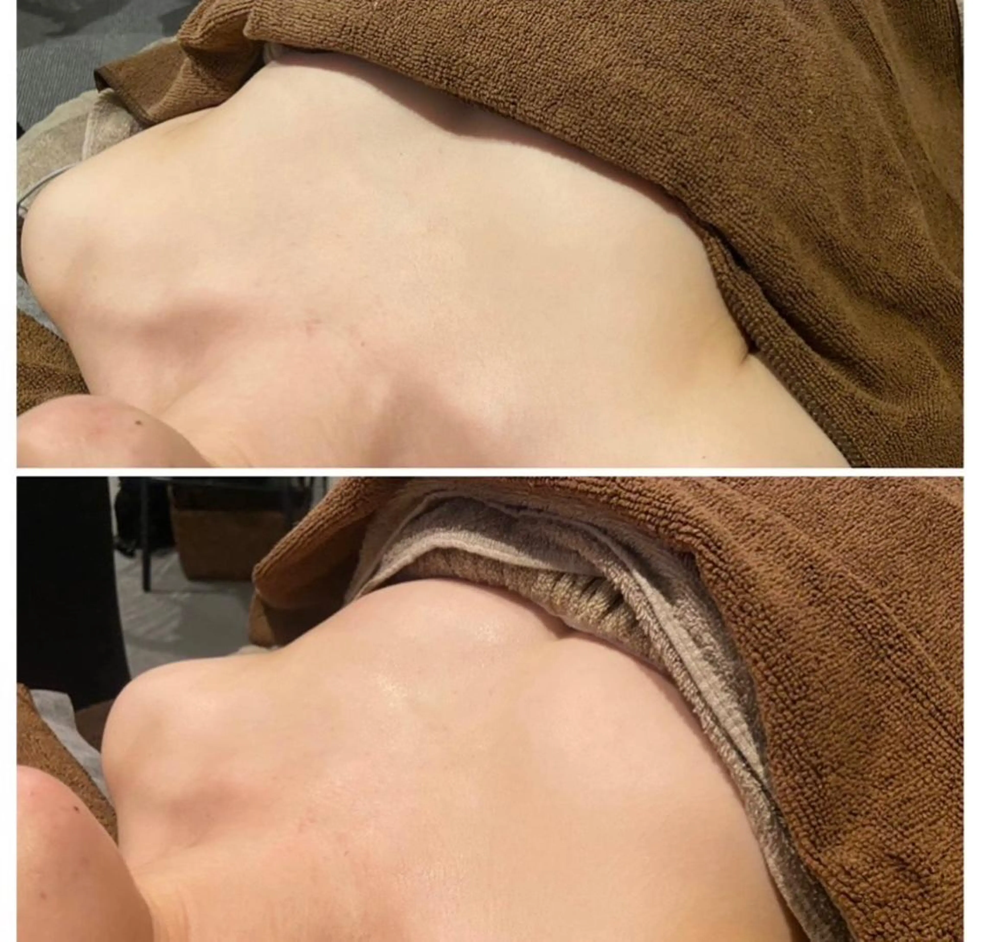 南森町・肌質改善 BELMIMARのエステ・リラクイメージ