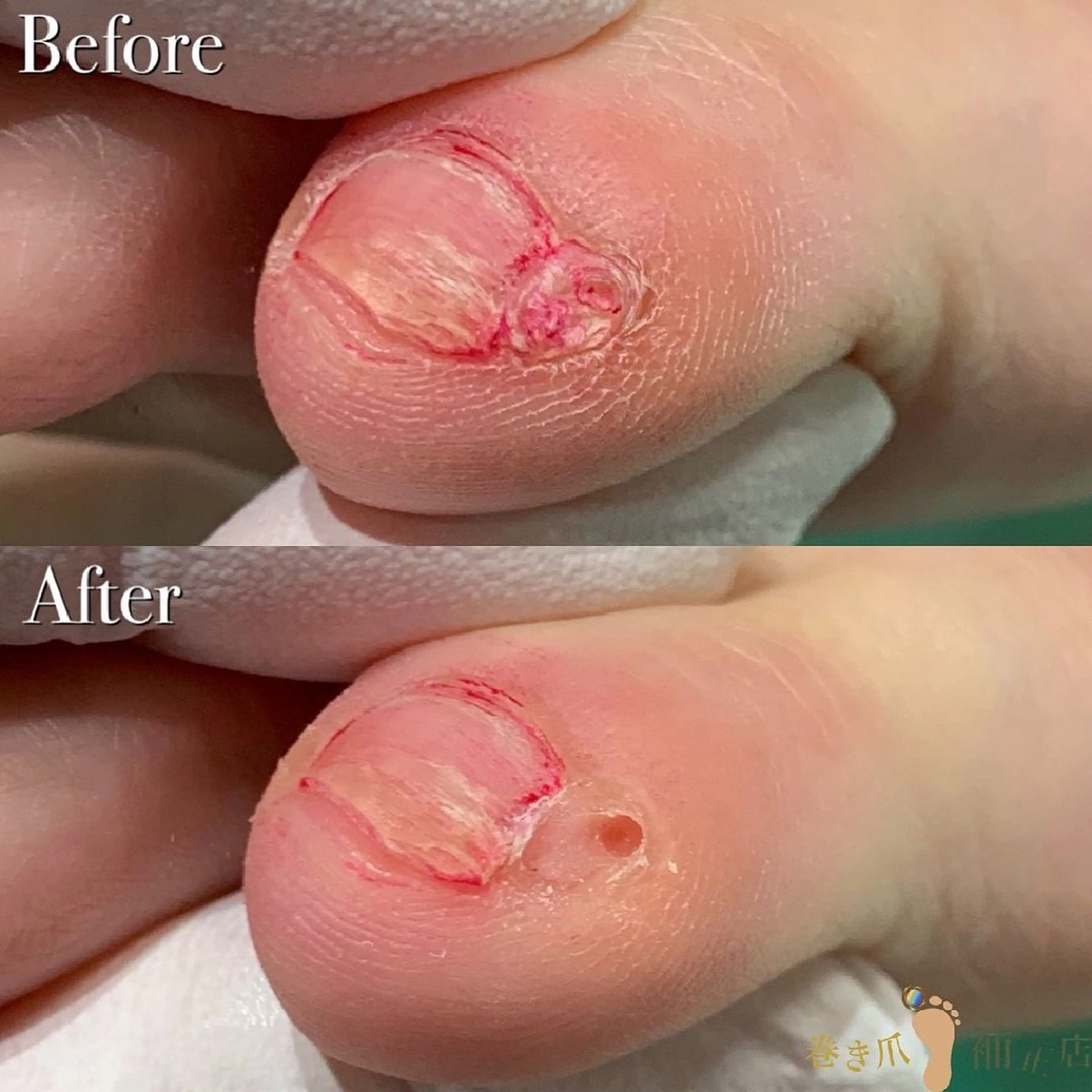 大宮 巻き爪補正店のエステ・リラクイメージ